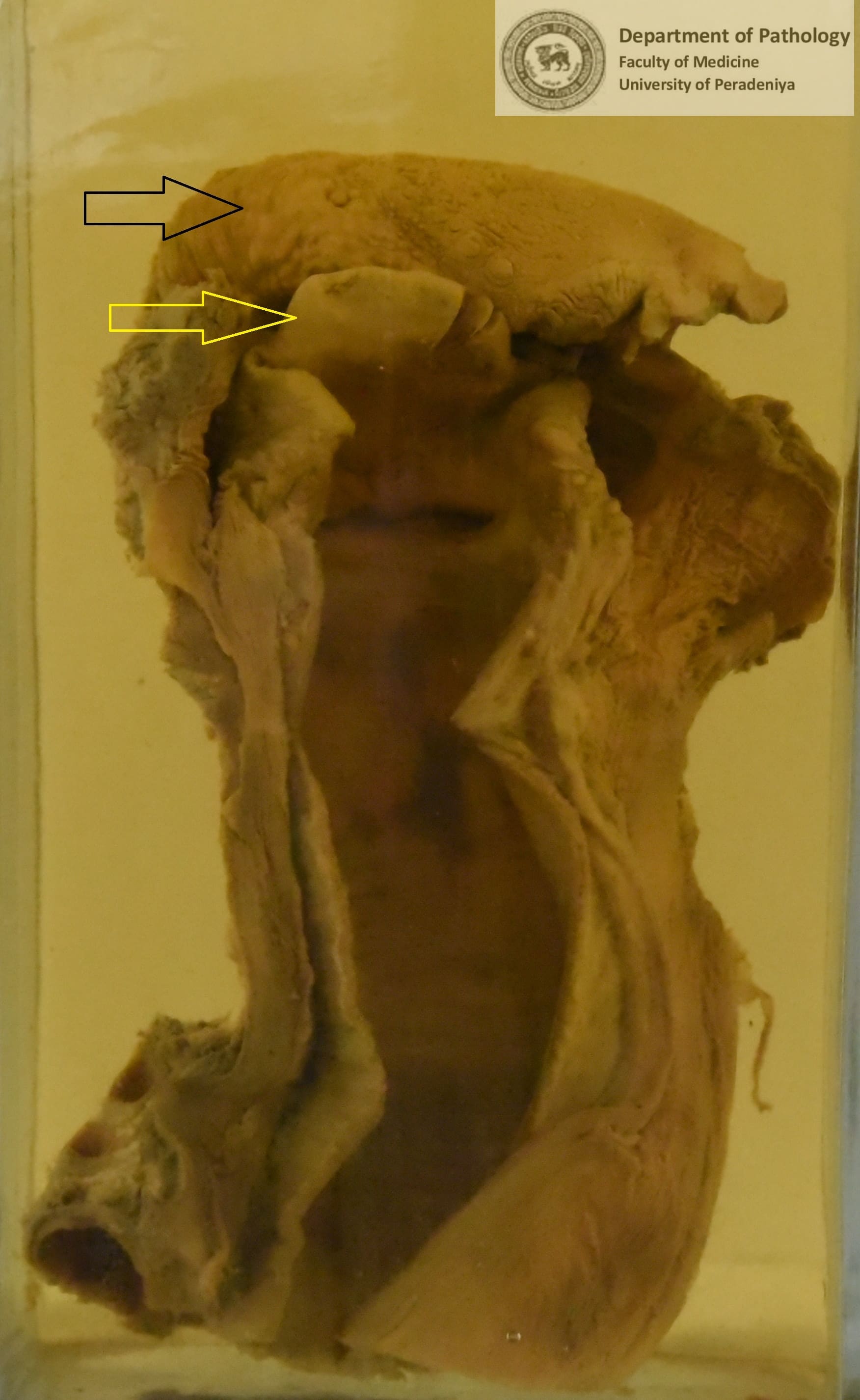E.7