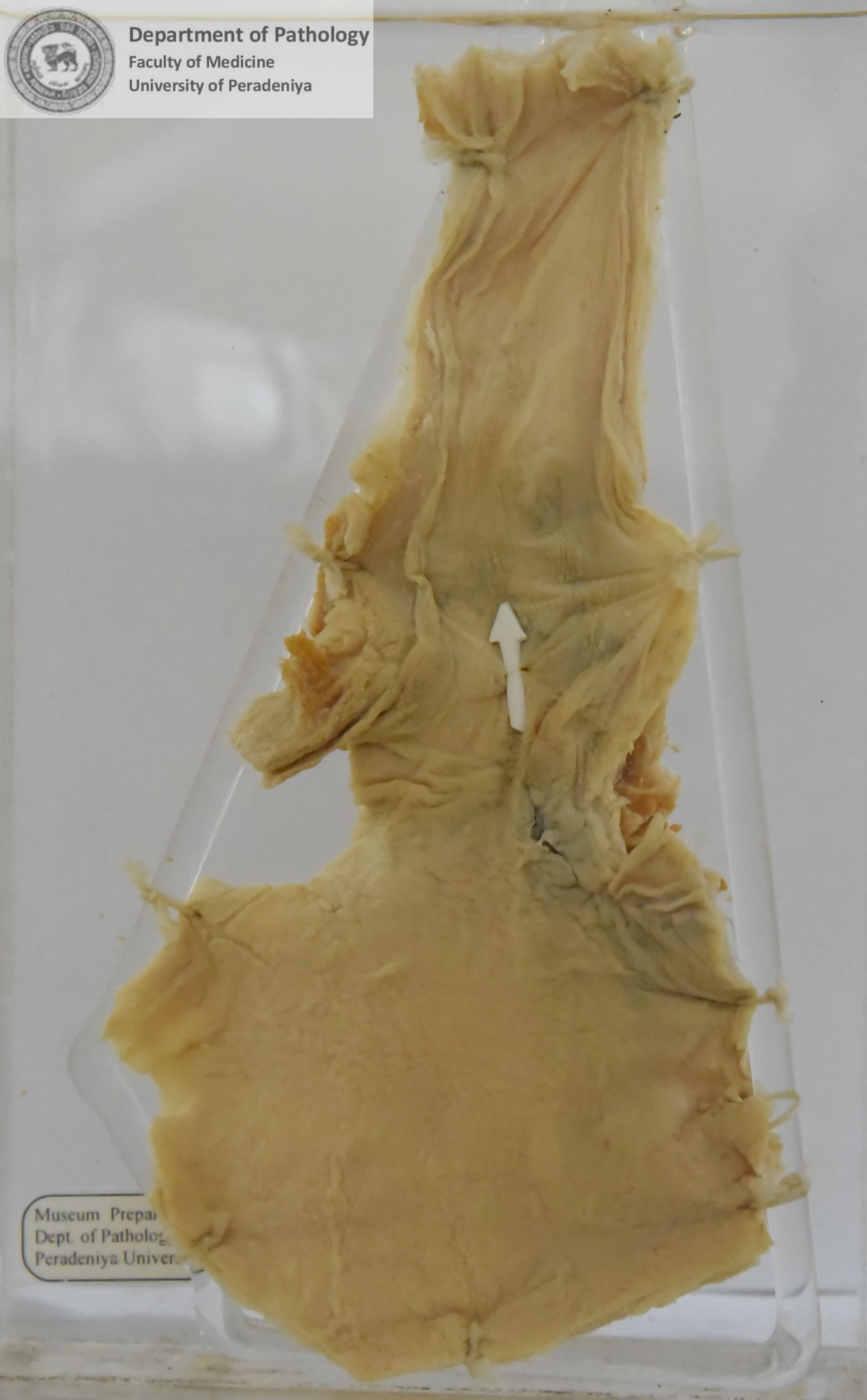 E.15