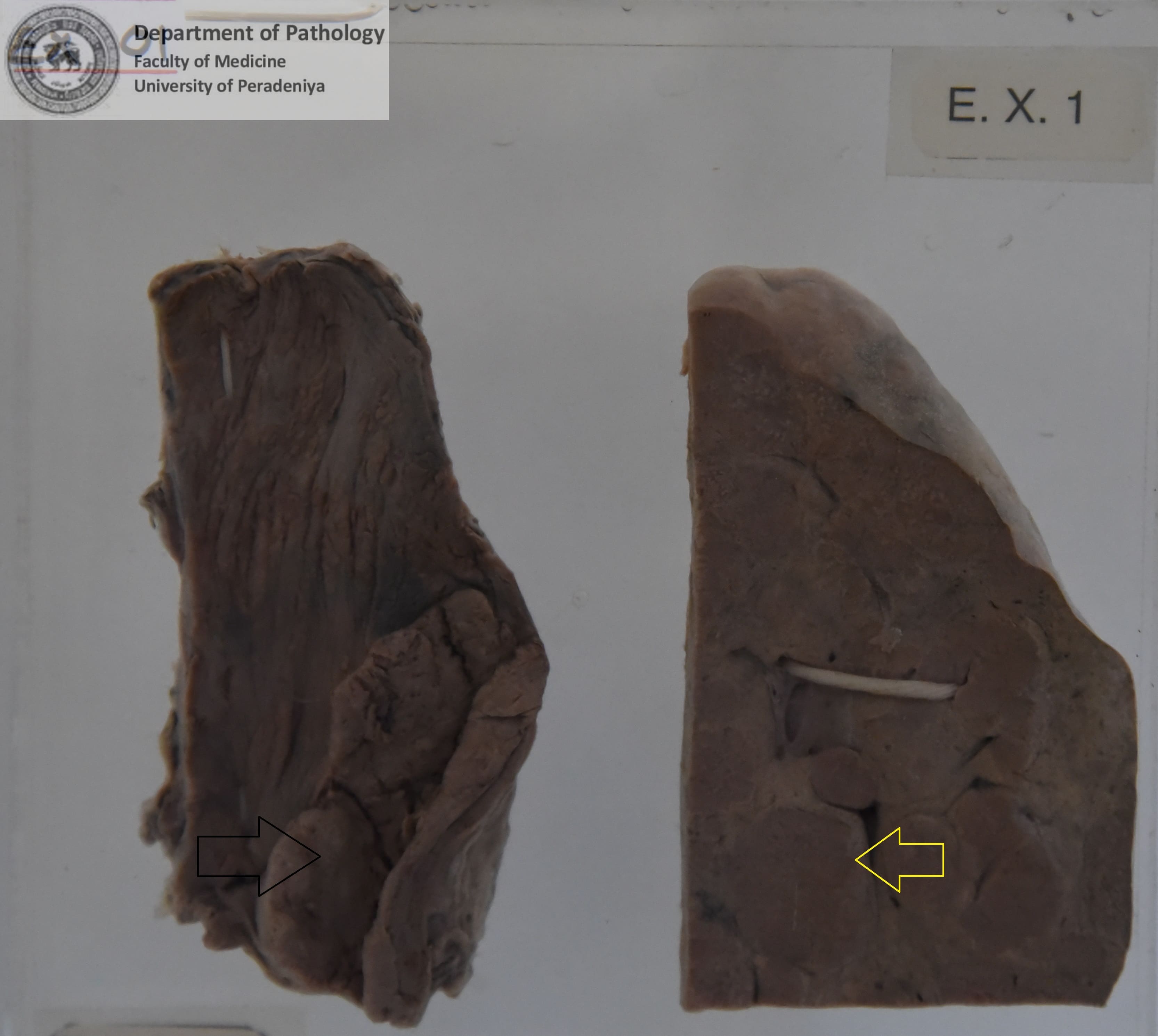 EX.1