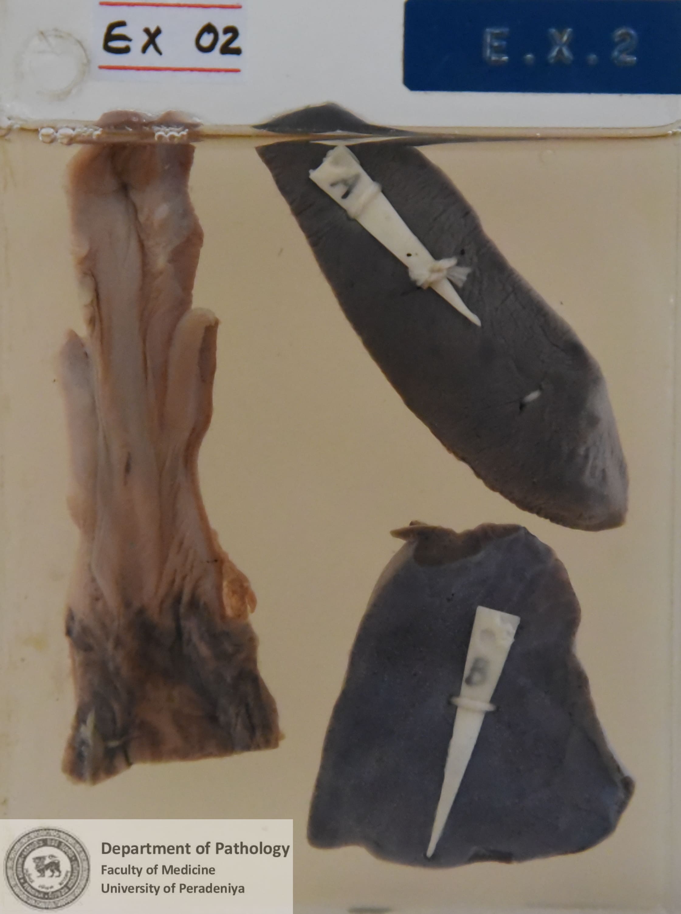 EX.2