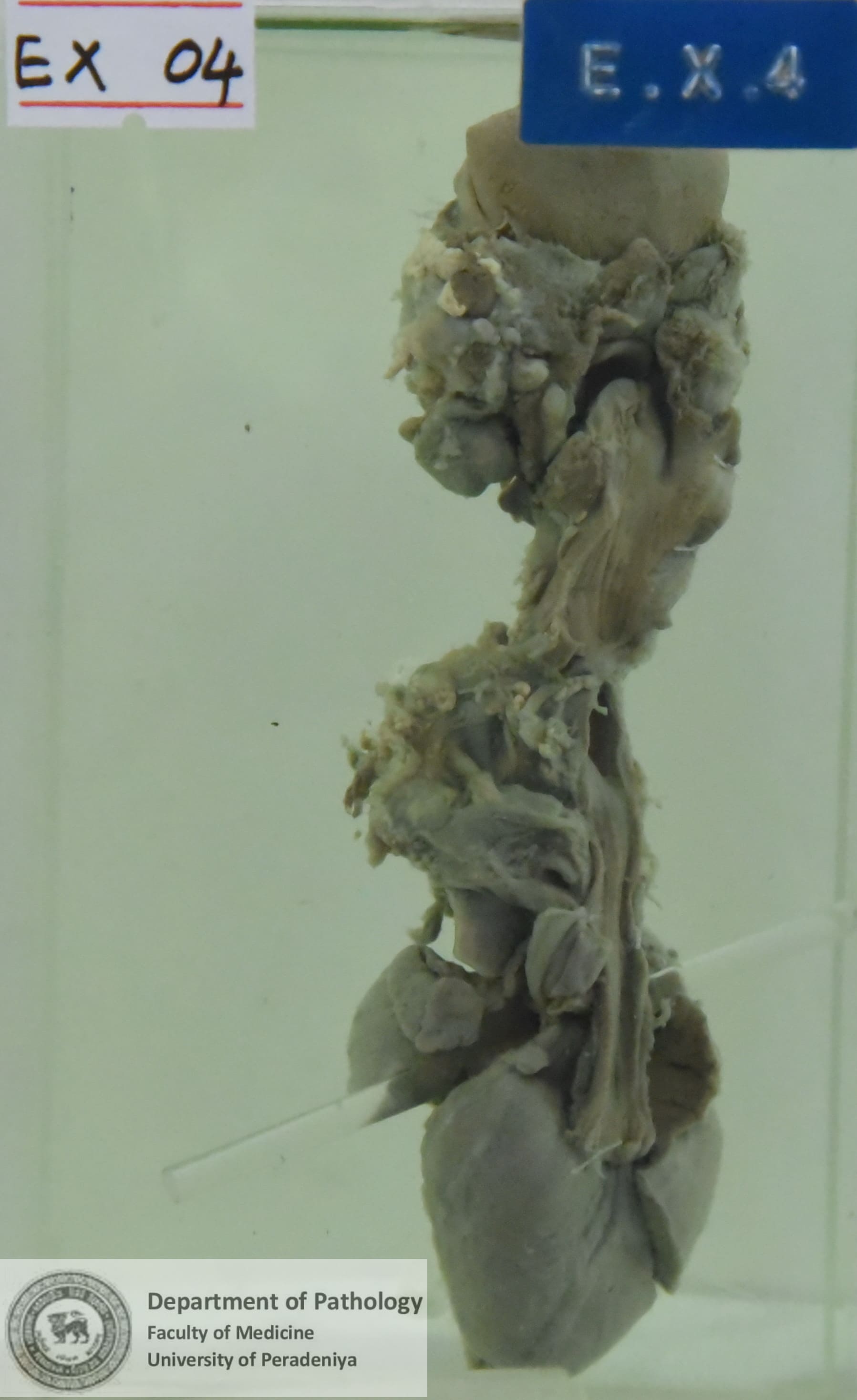 EX.4