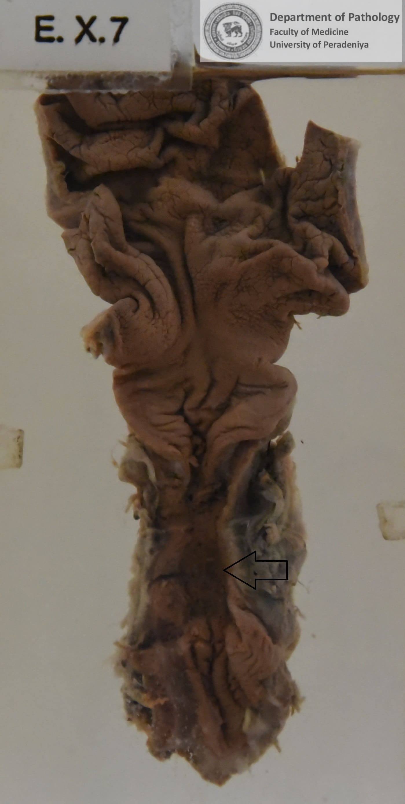EX.7