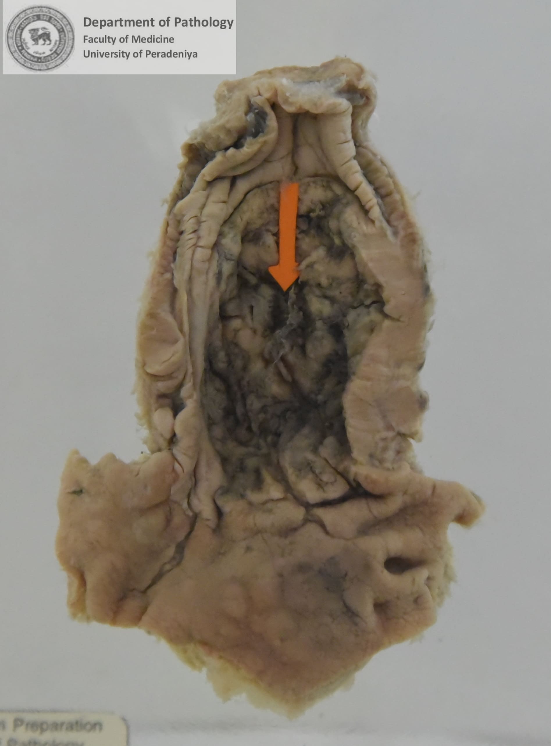 EX.13