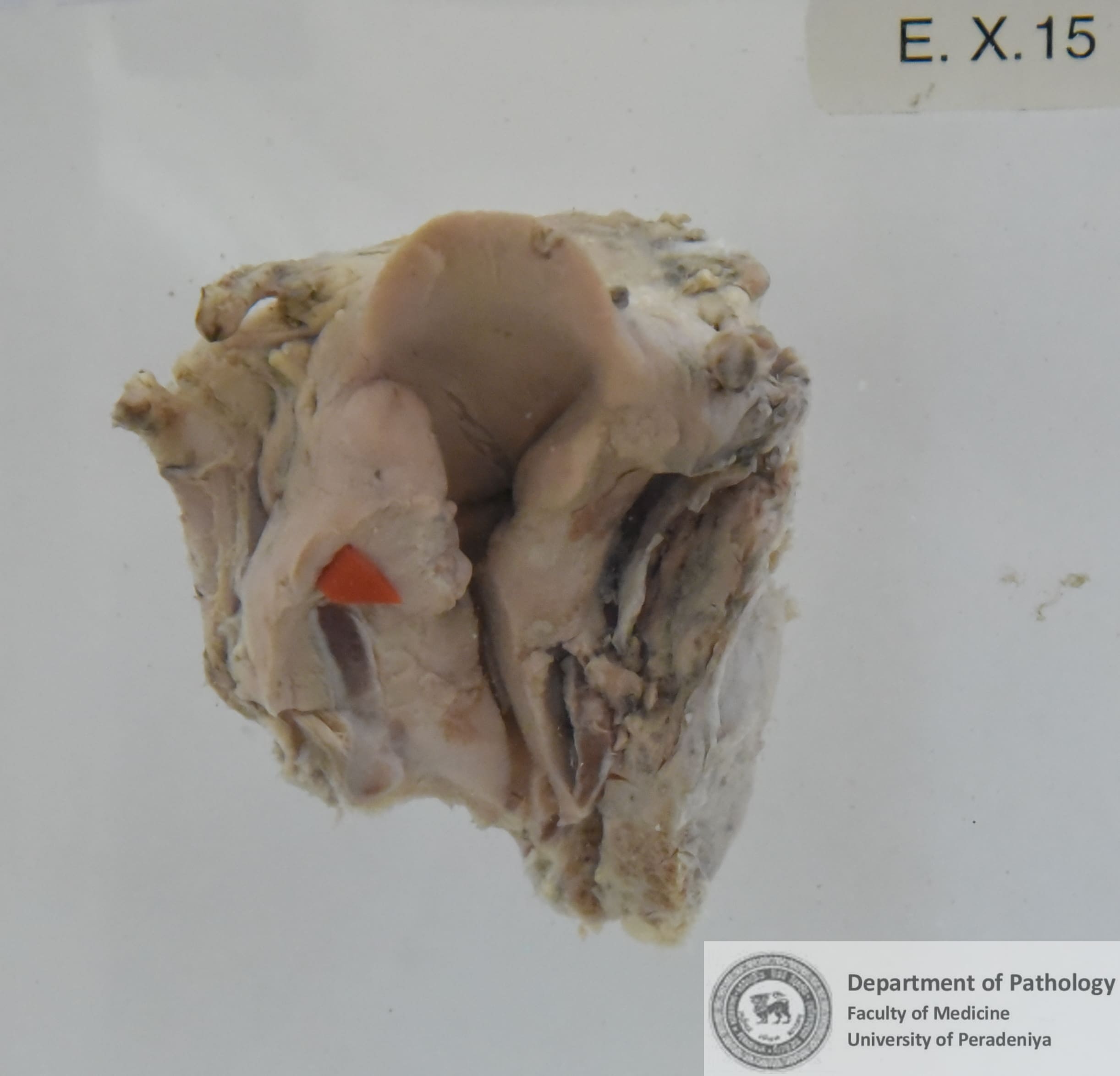 EX.15