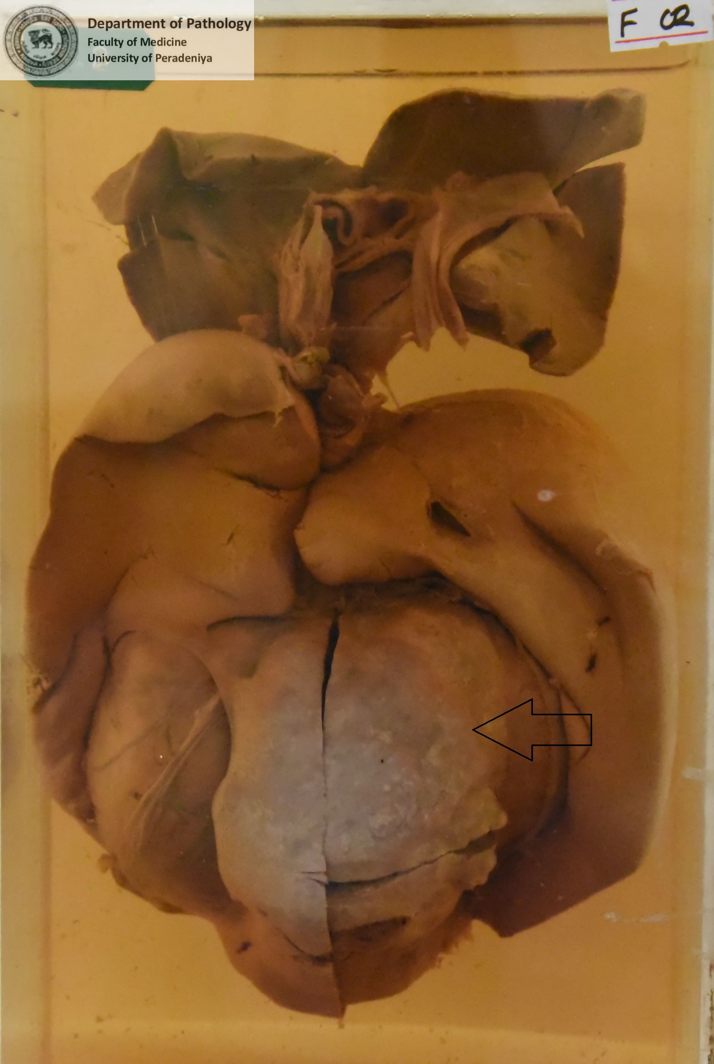 F.2