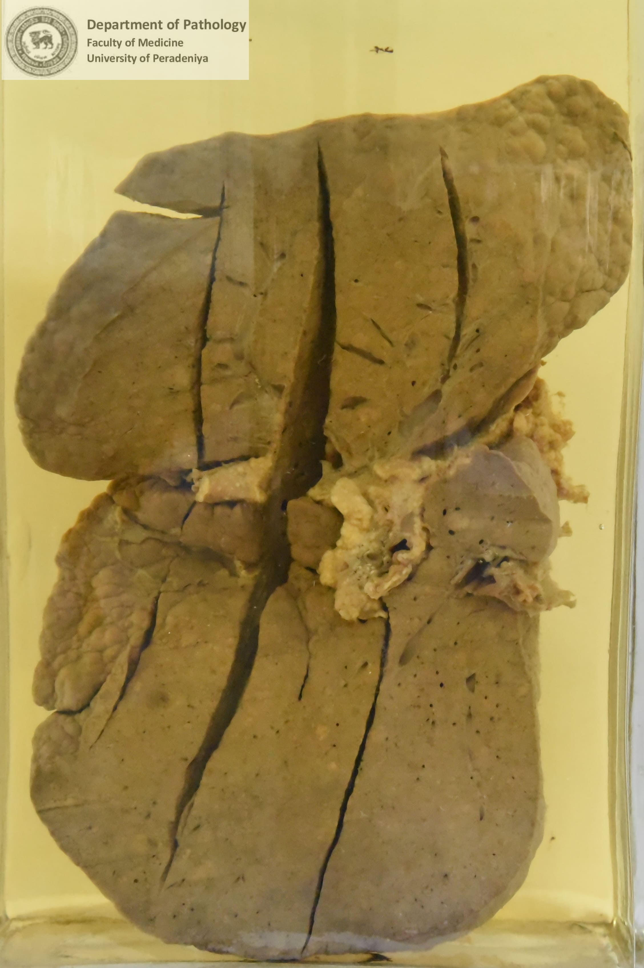 F.15
