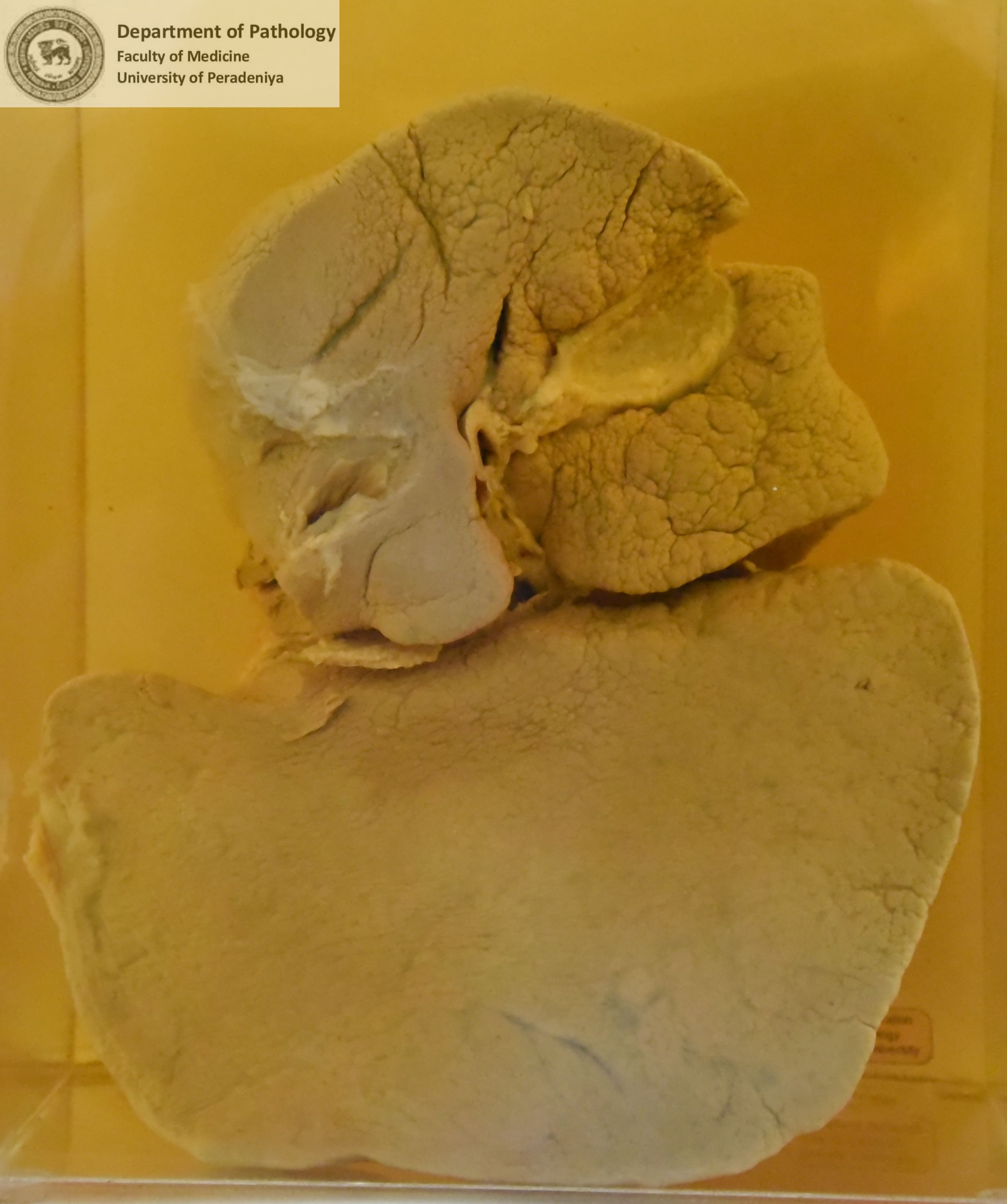 F.19