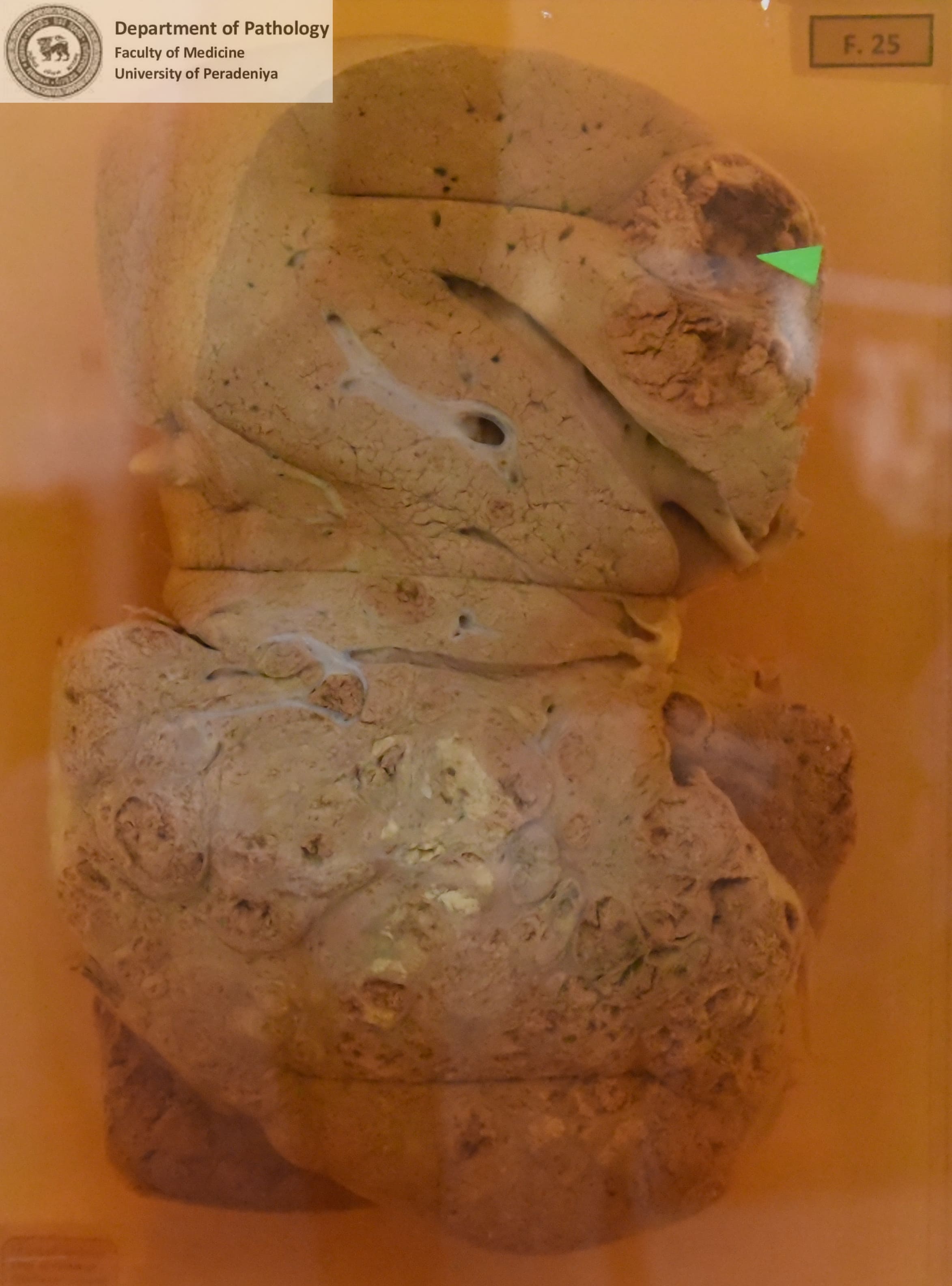 F.25