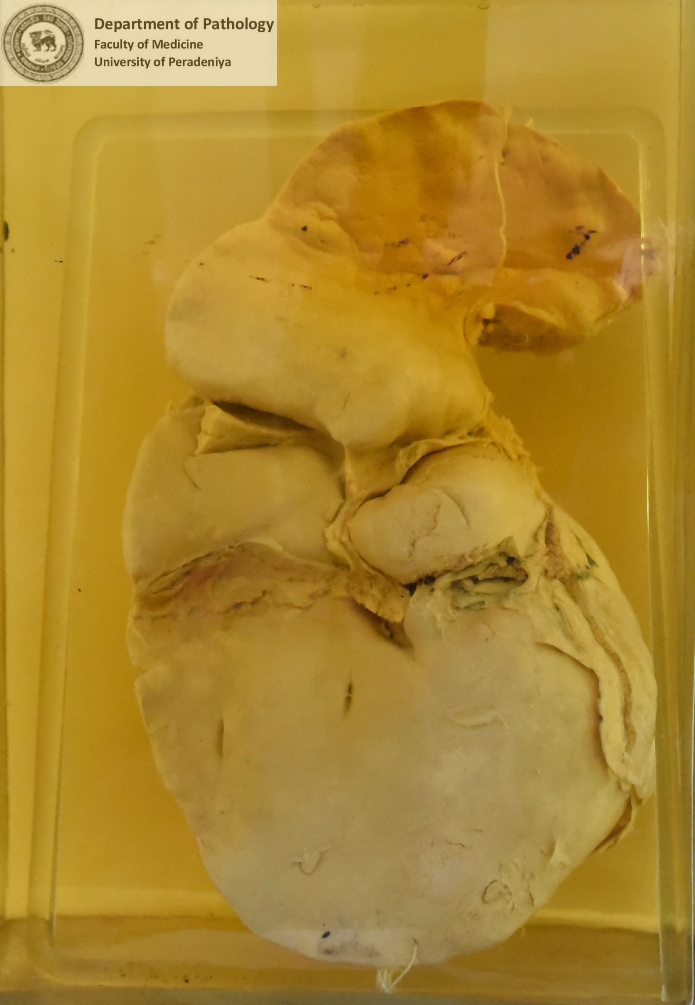 F.53