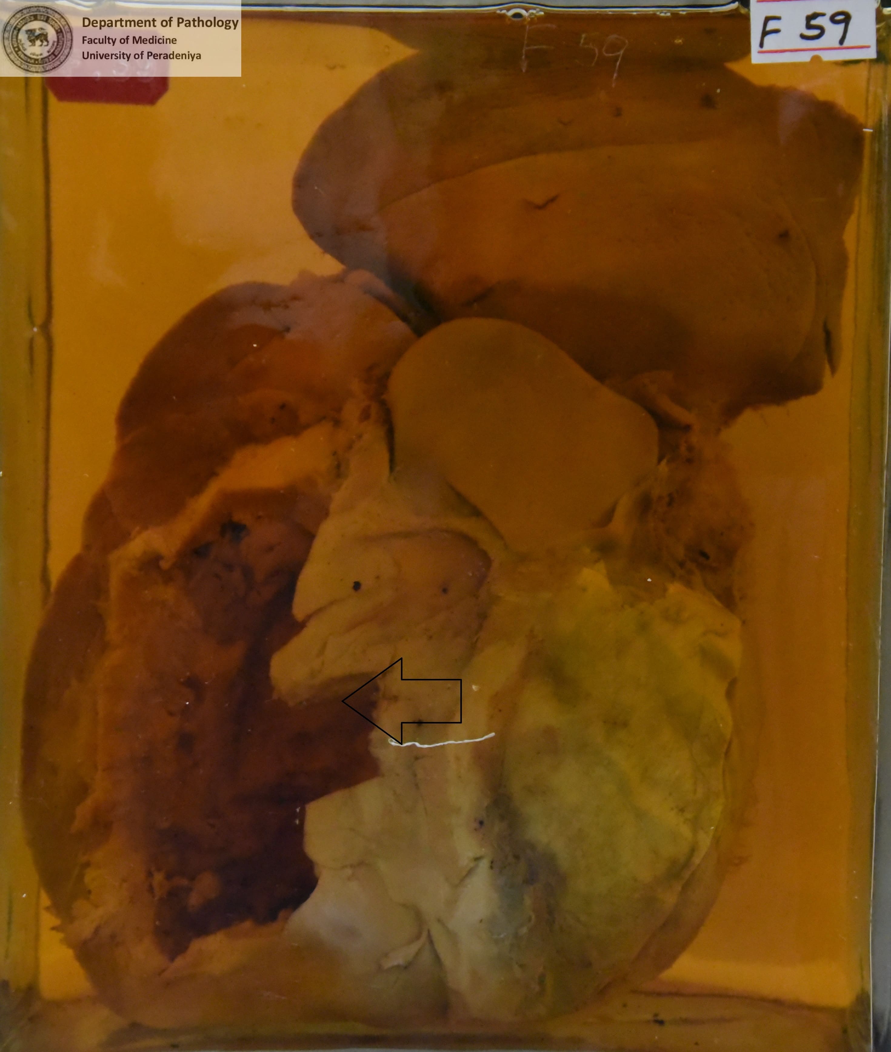 F.59