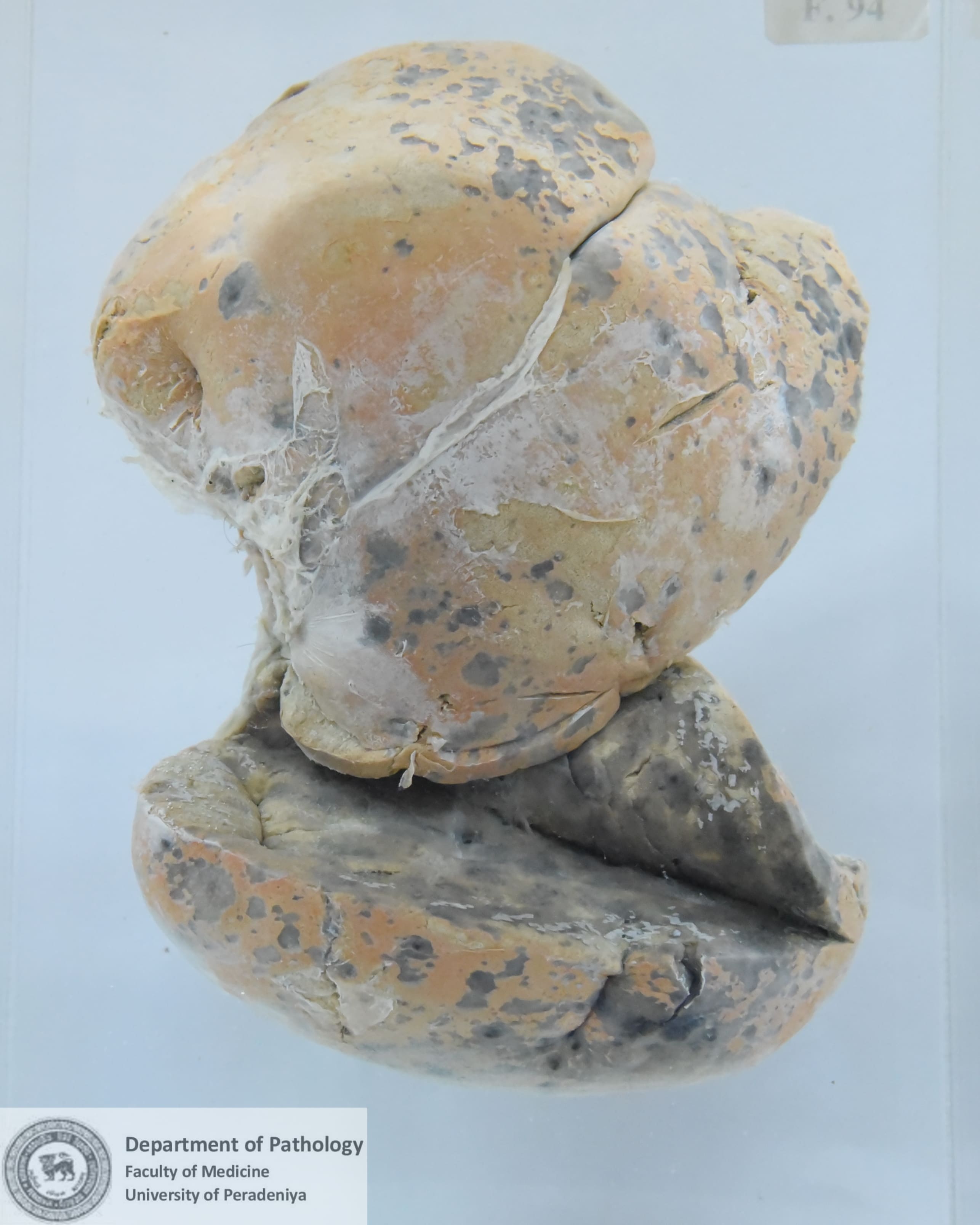 F.94