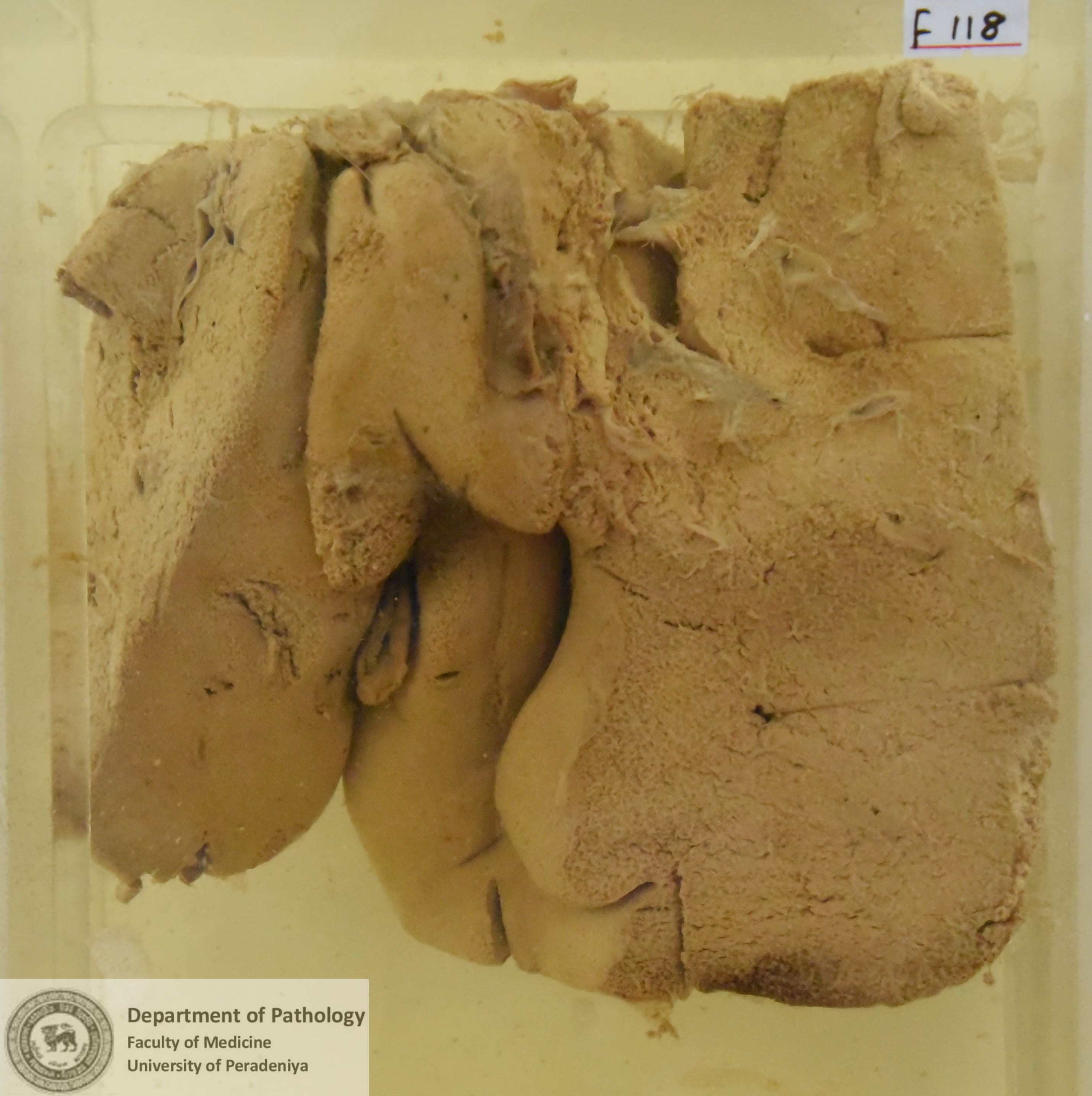F.118