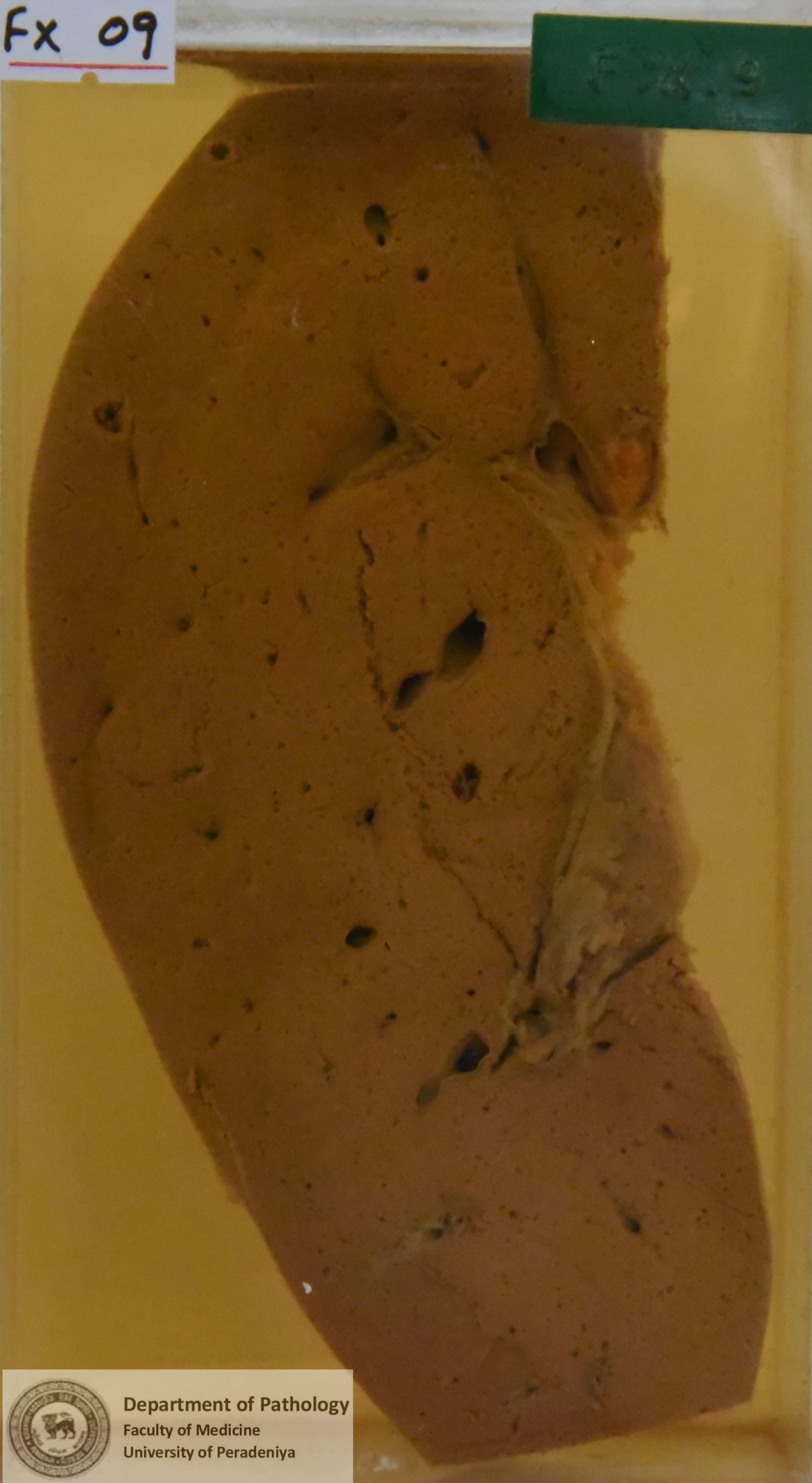 FX.9