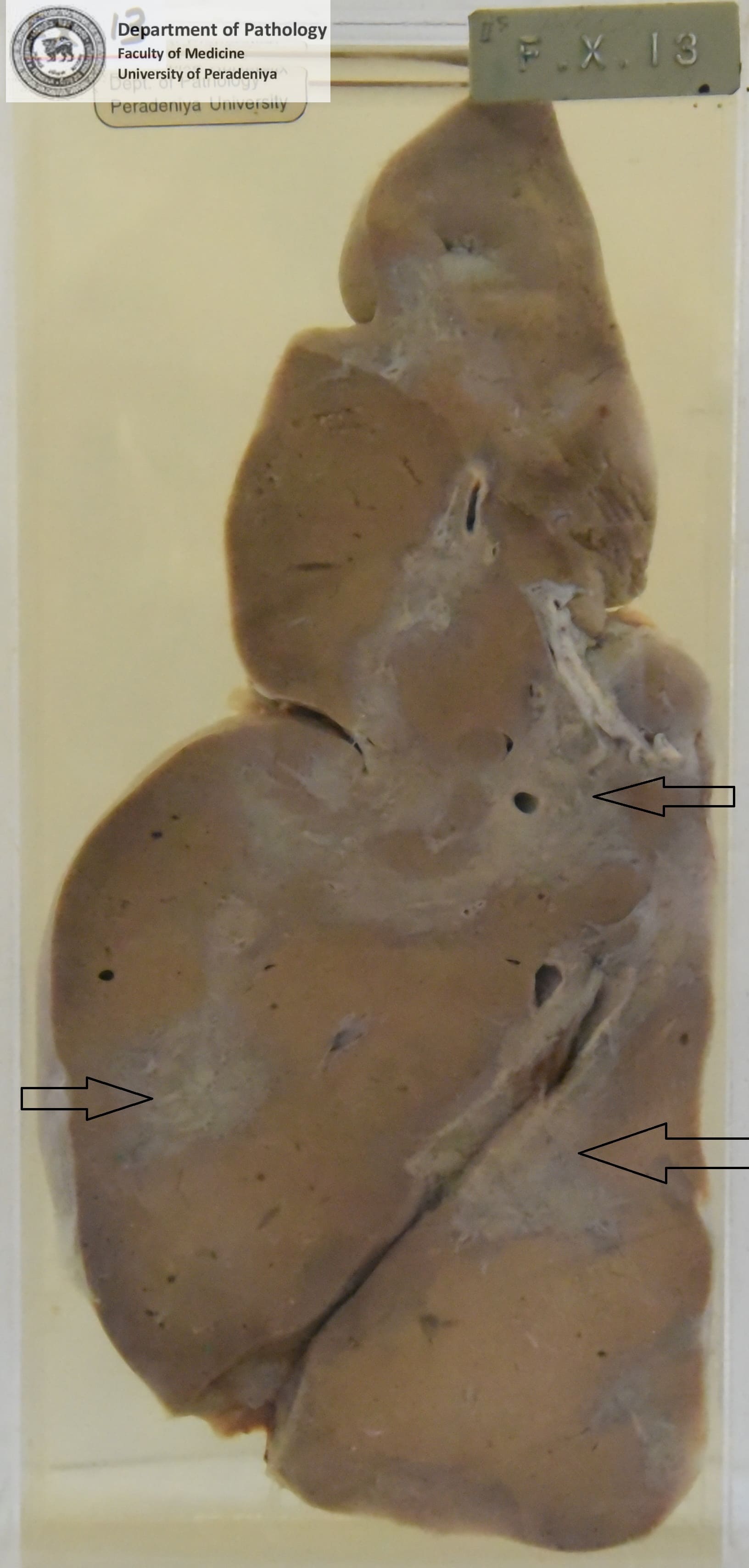FX.13