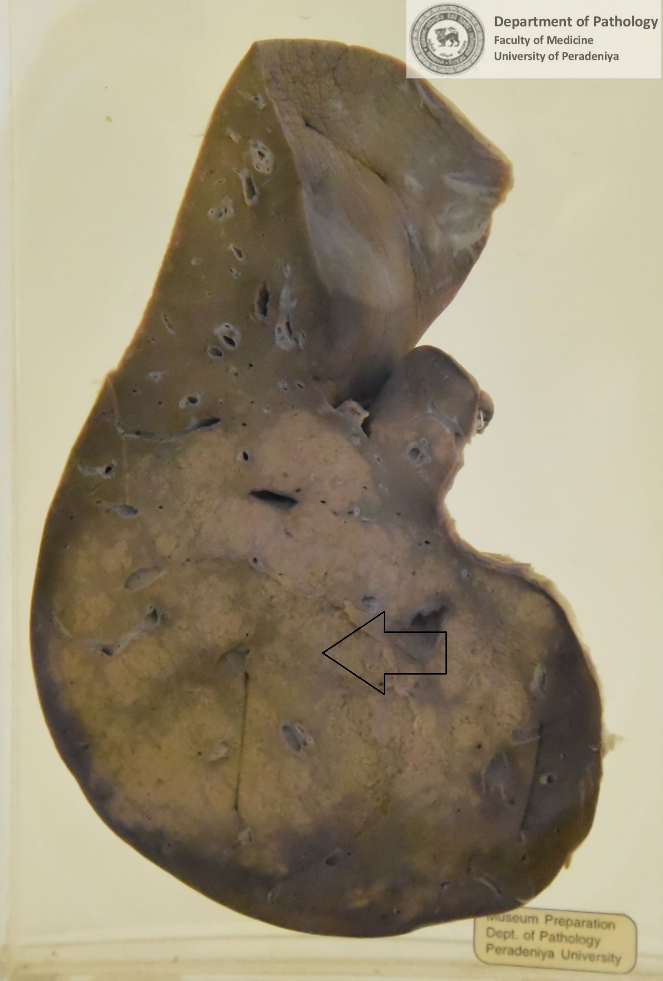 FX.14
