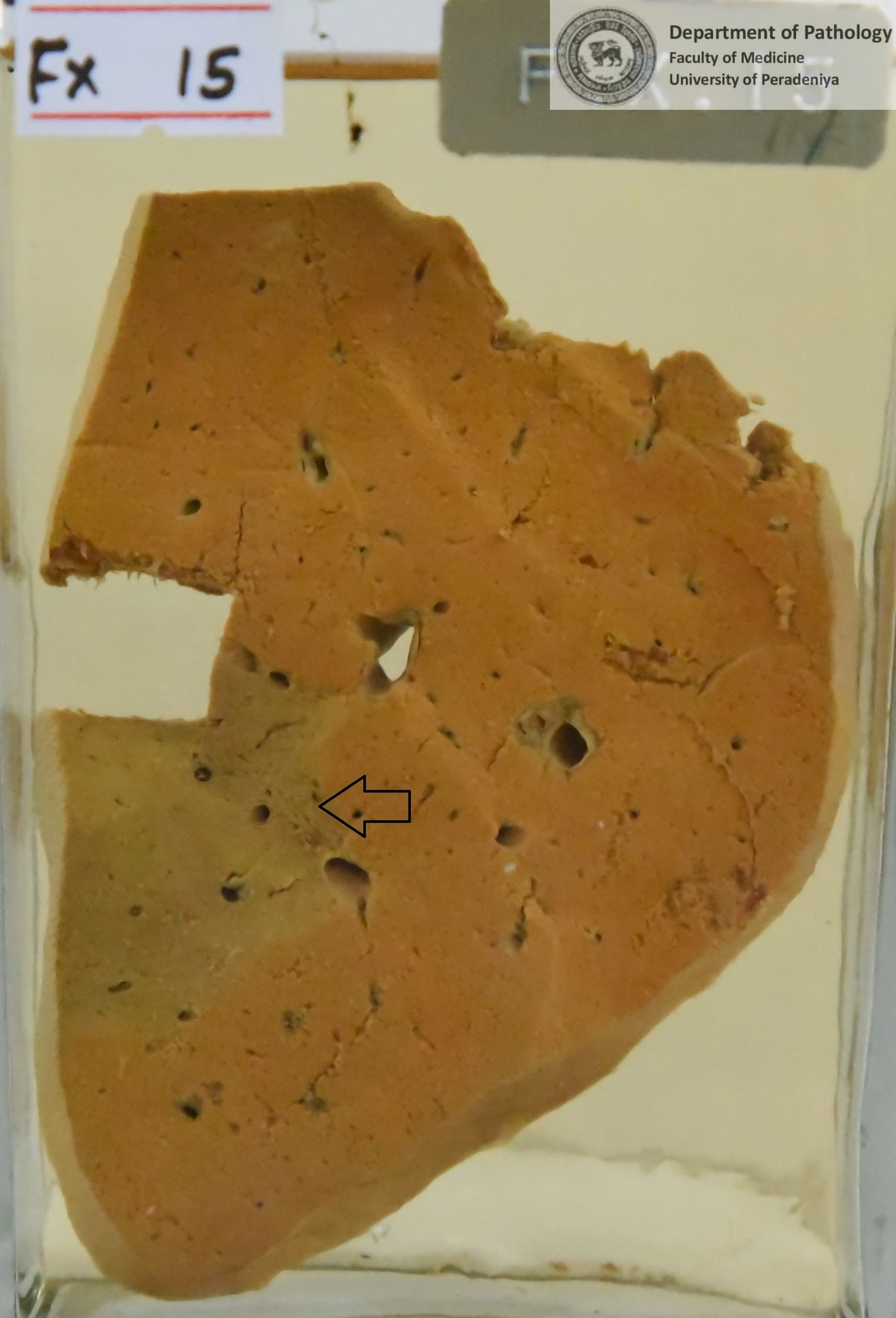 FX.15