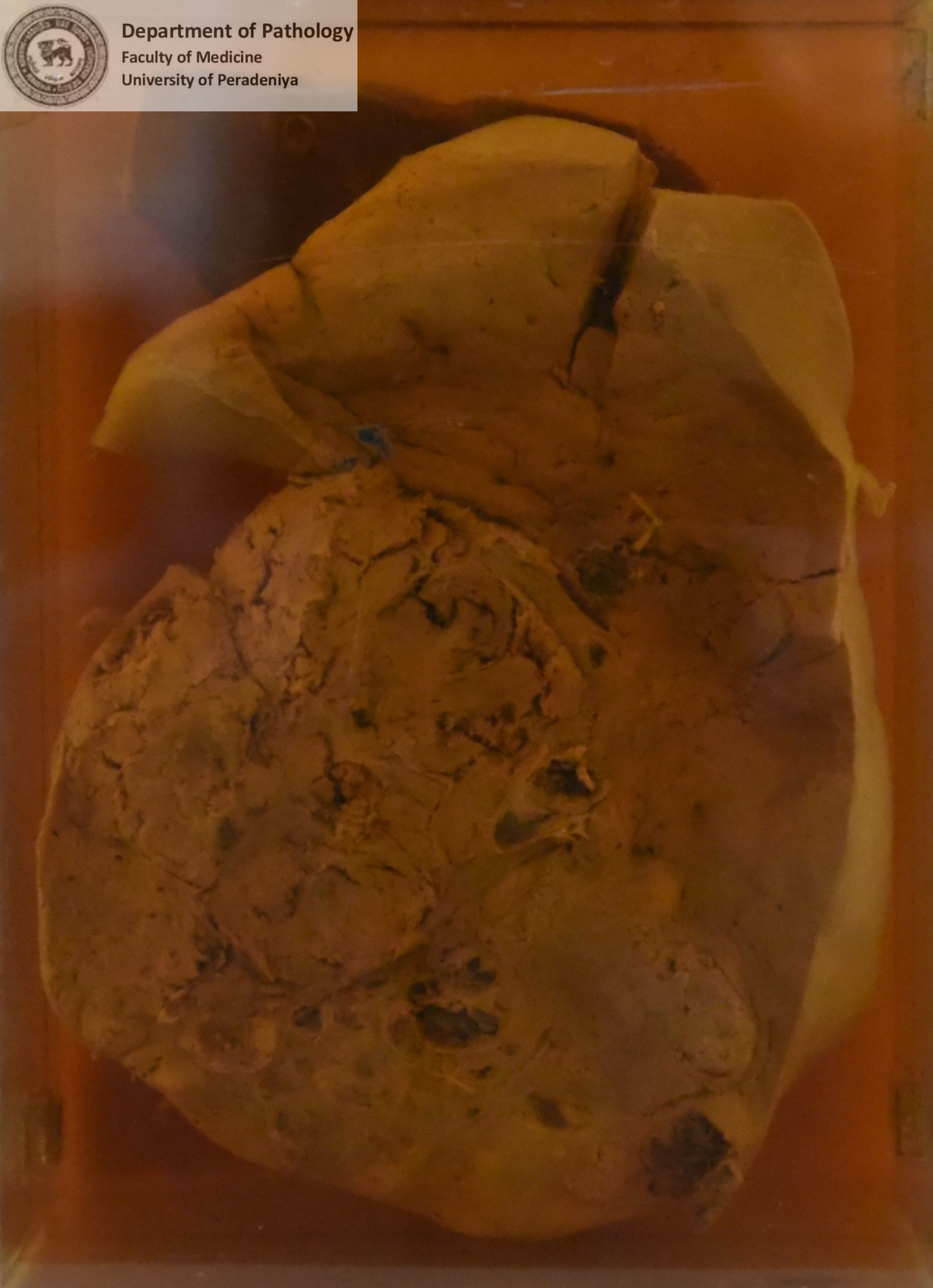 FX.18