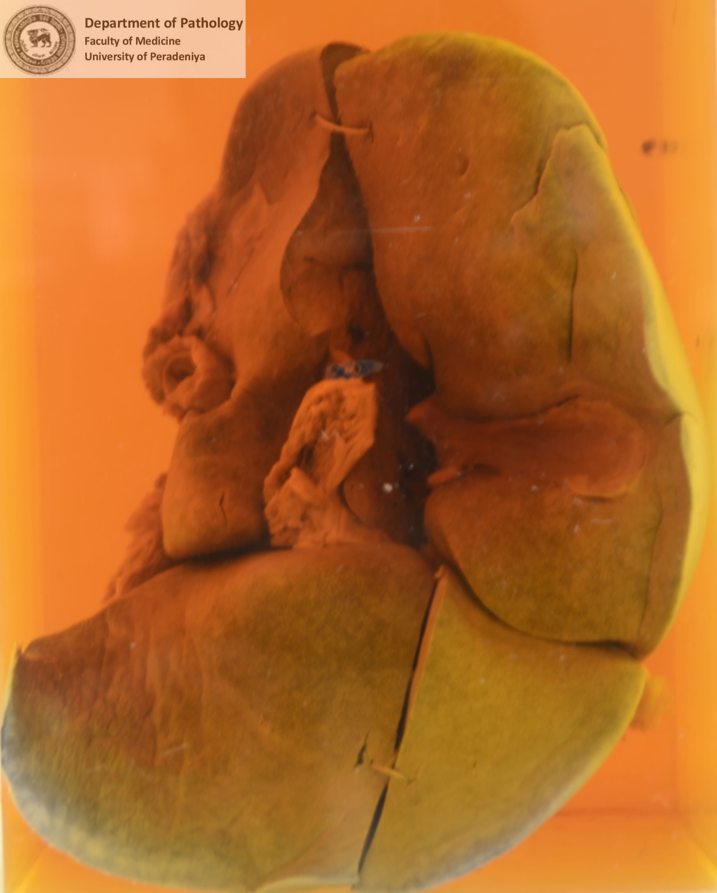 FX.19