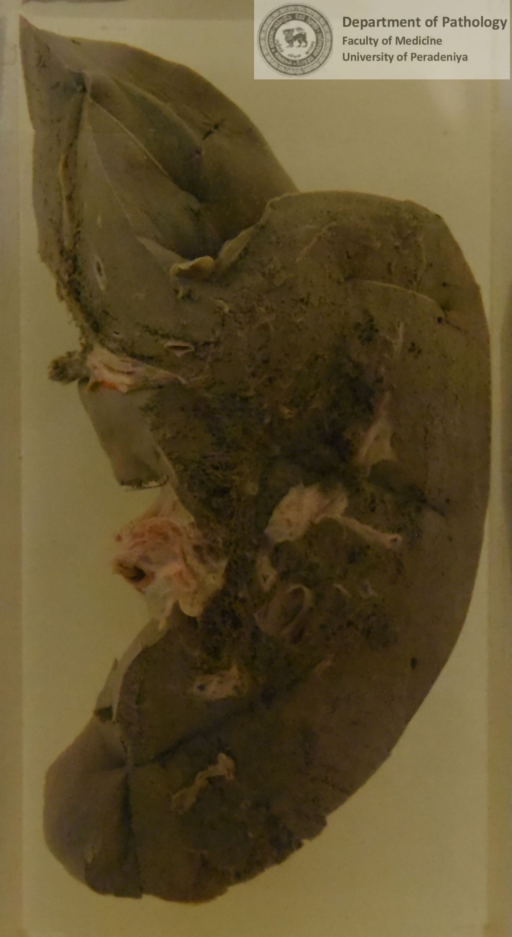 FX.22