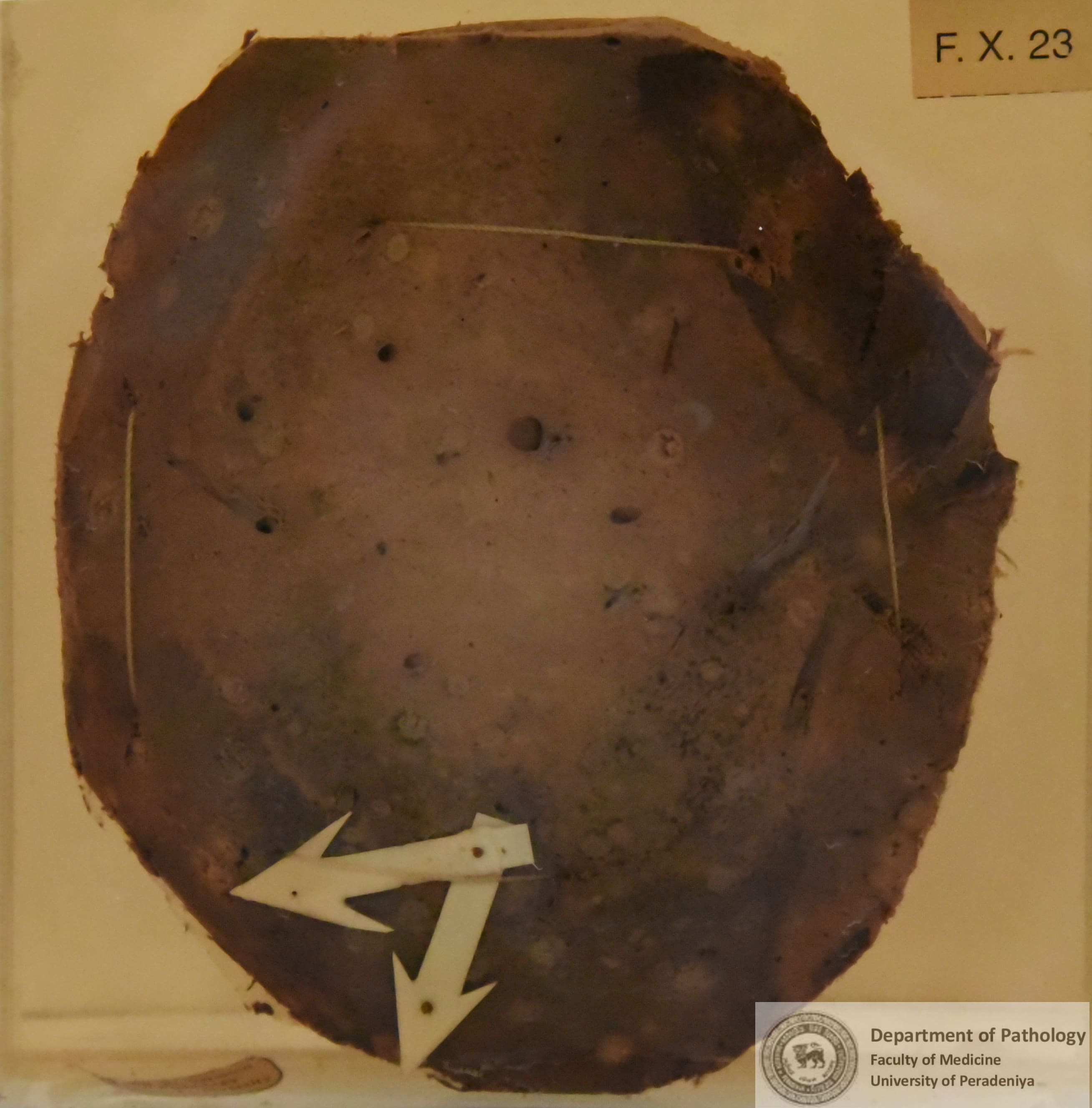FX.23