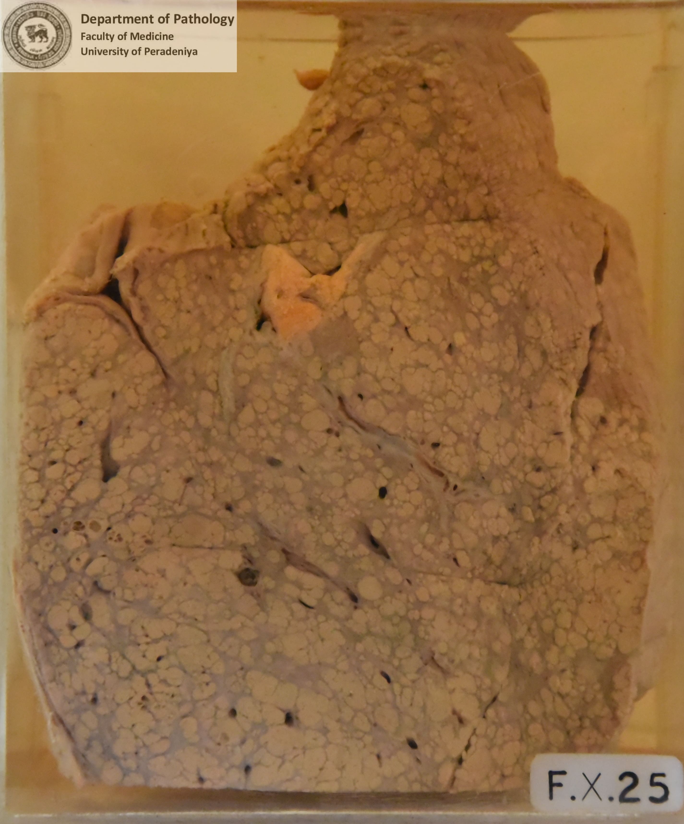 FX.25