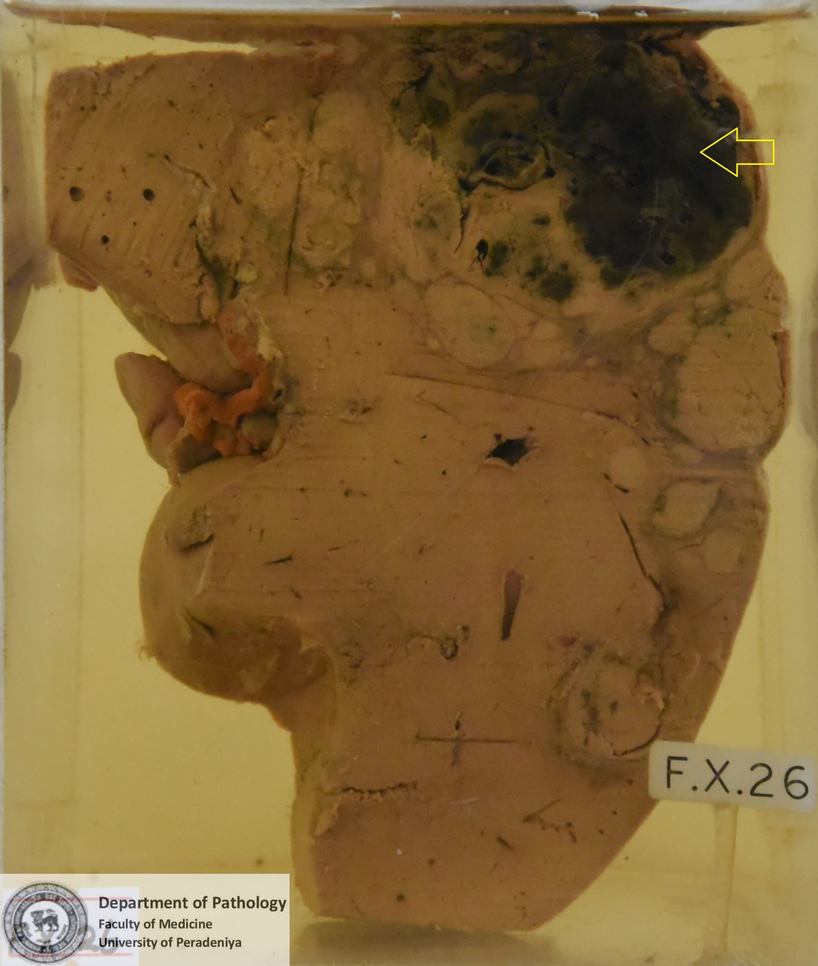 FX.26