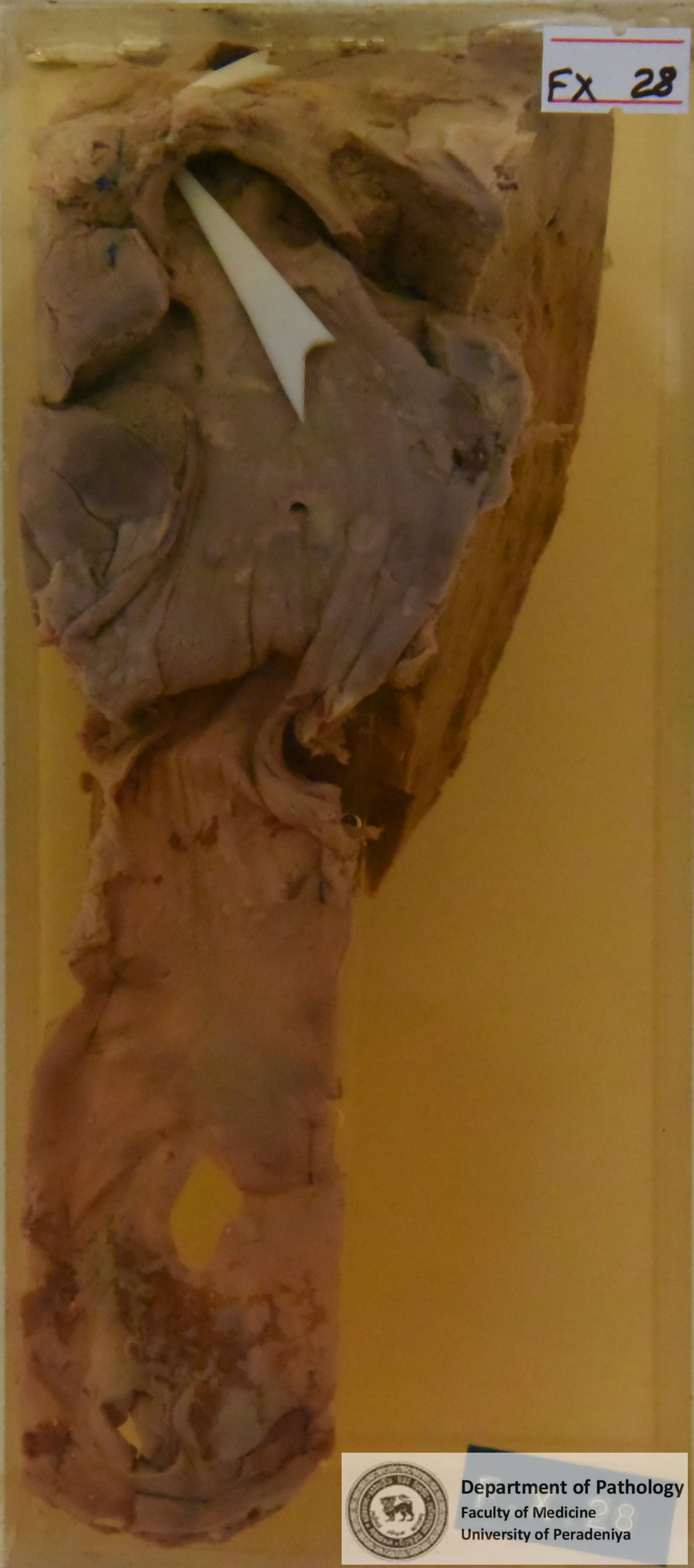 FX.28