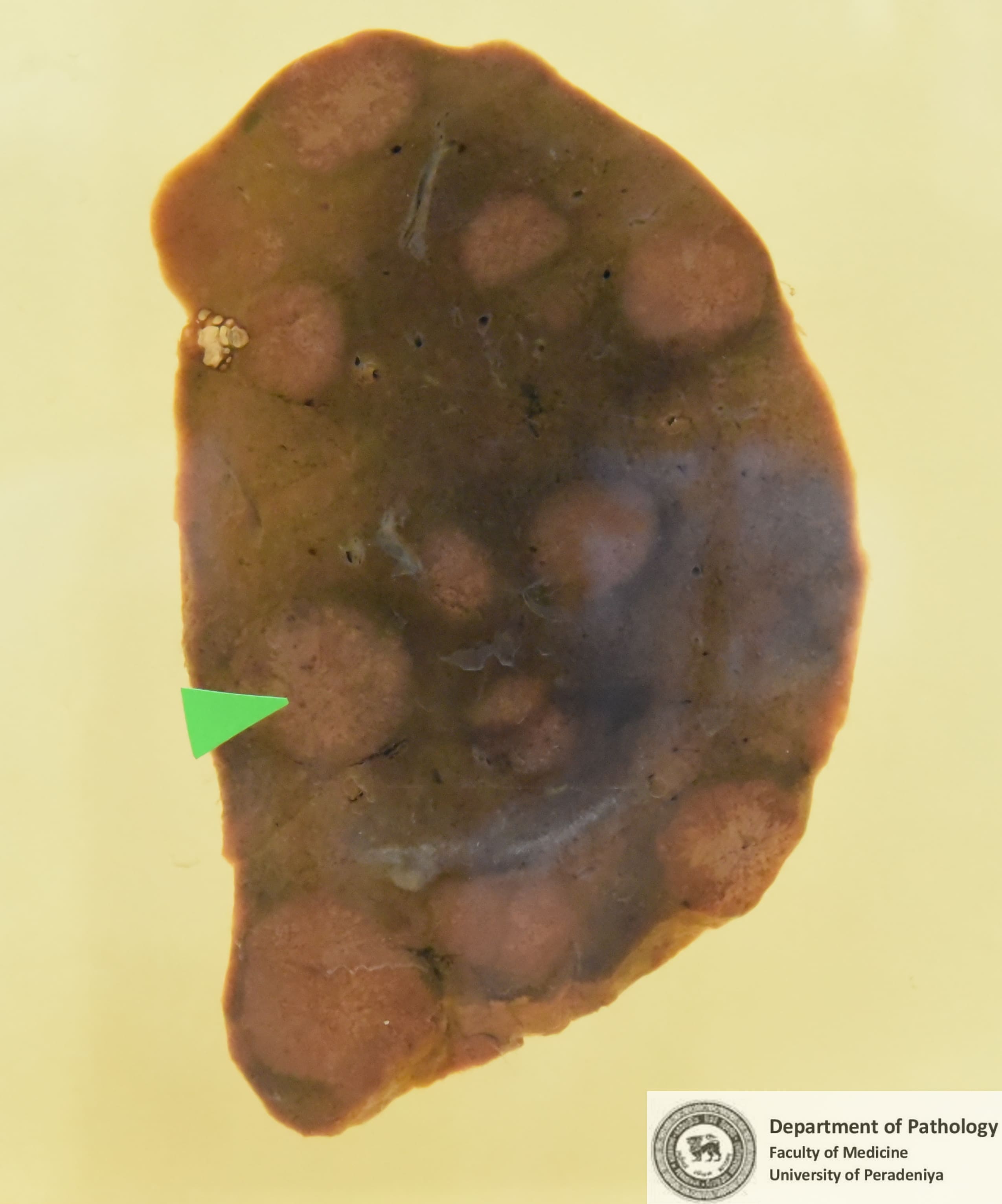 FX.32