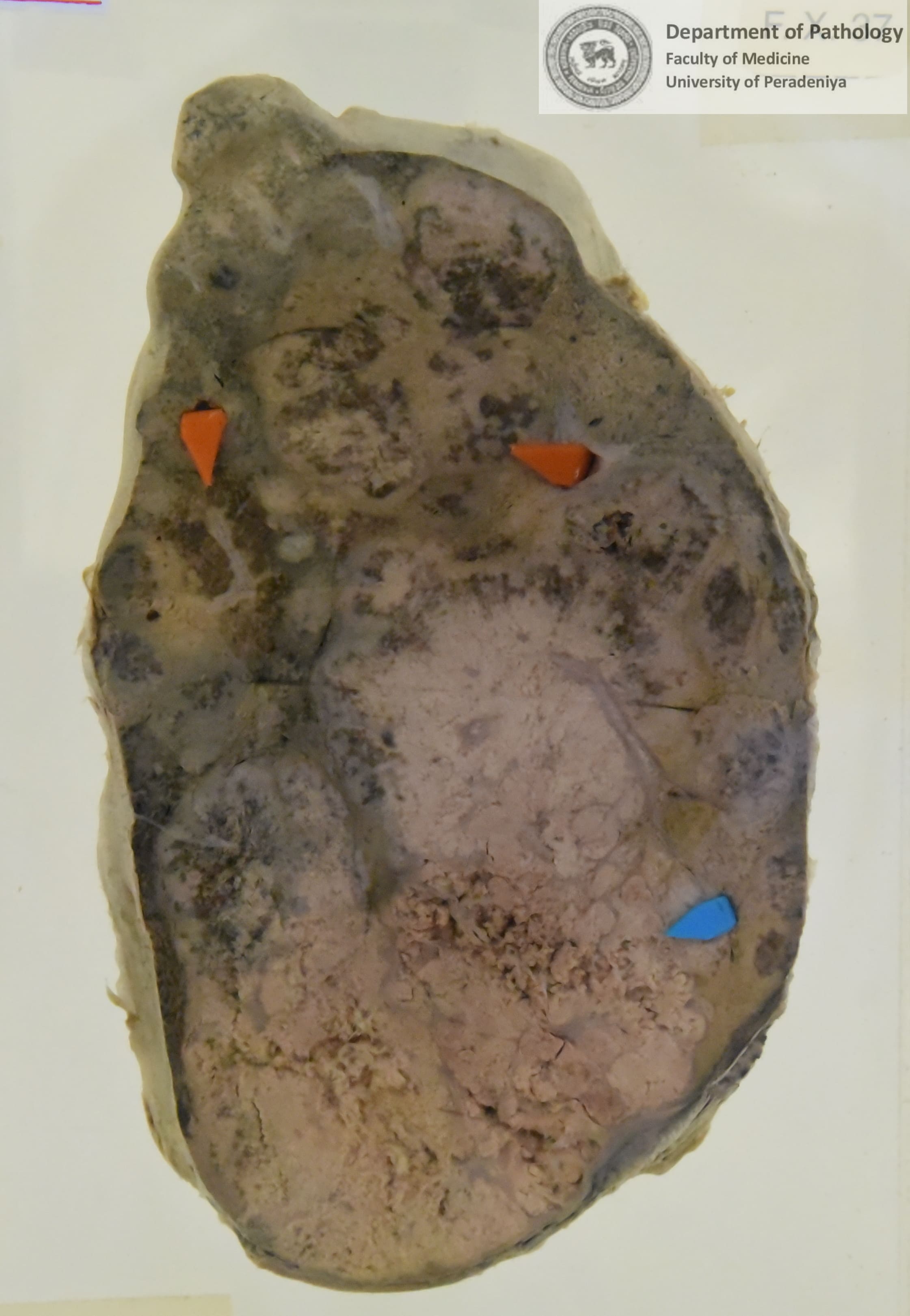 FX.37