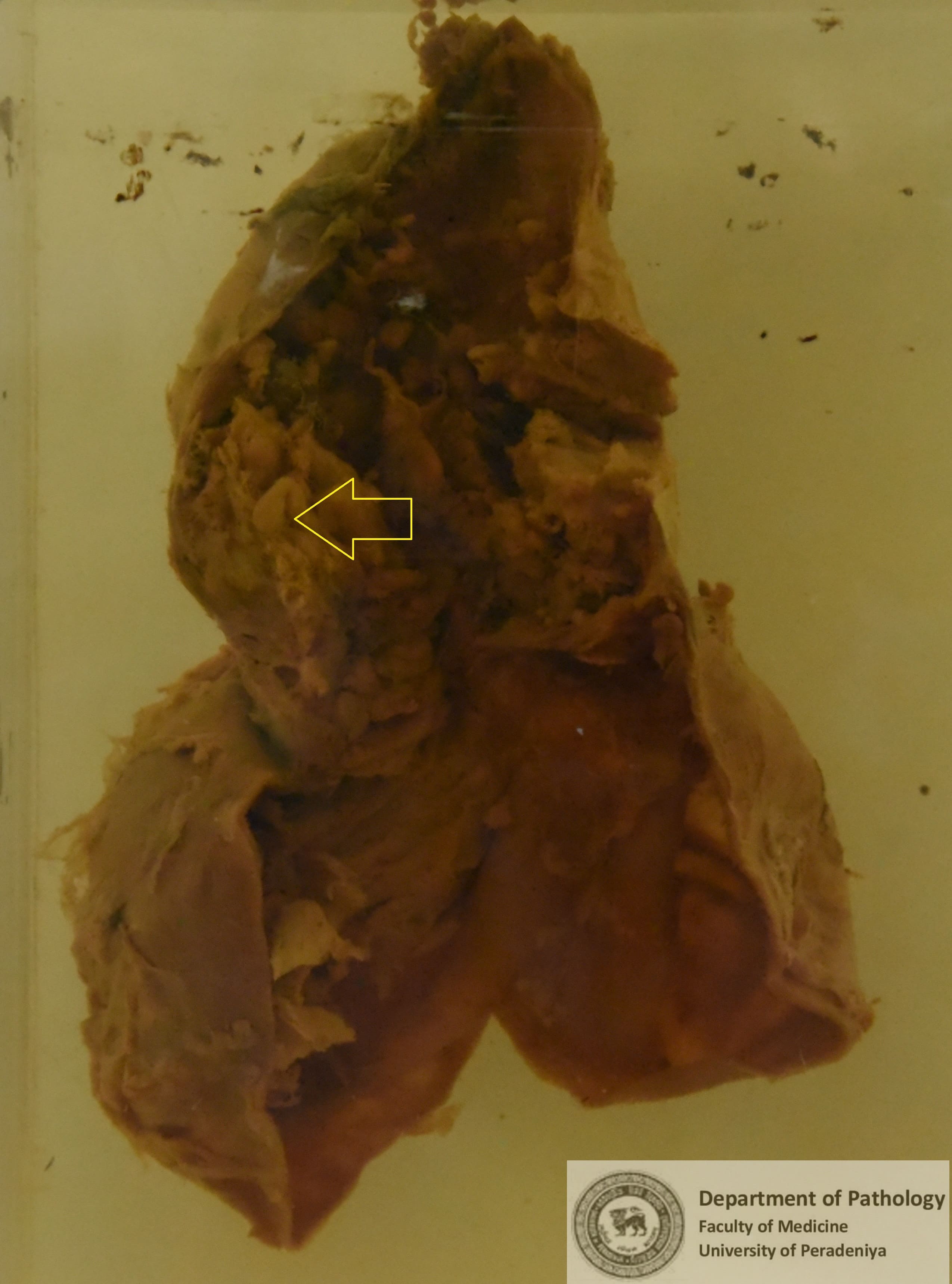 F a .1