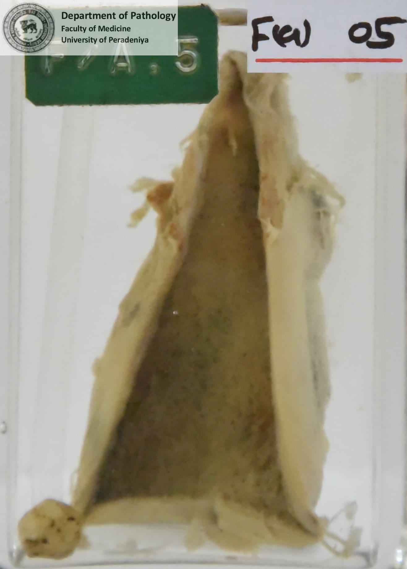 F a .5