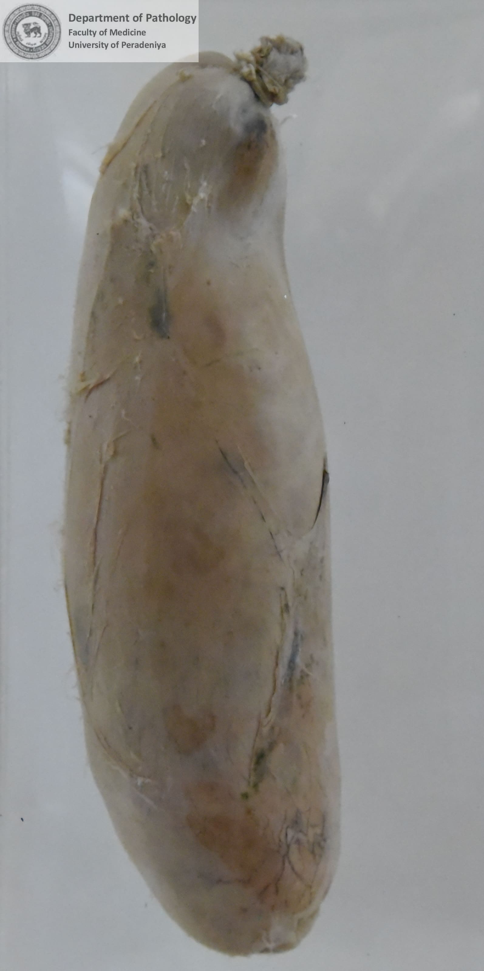 F a .25