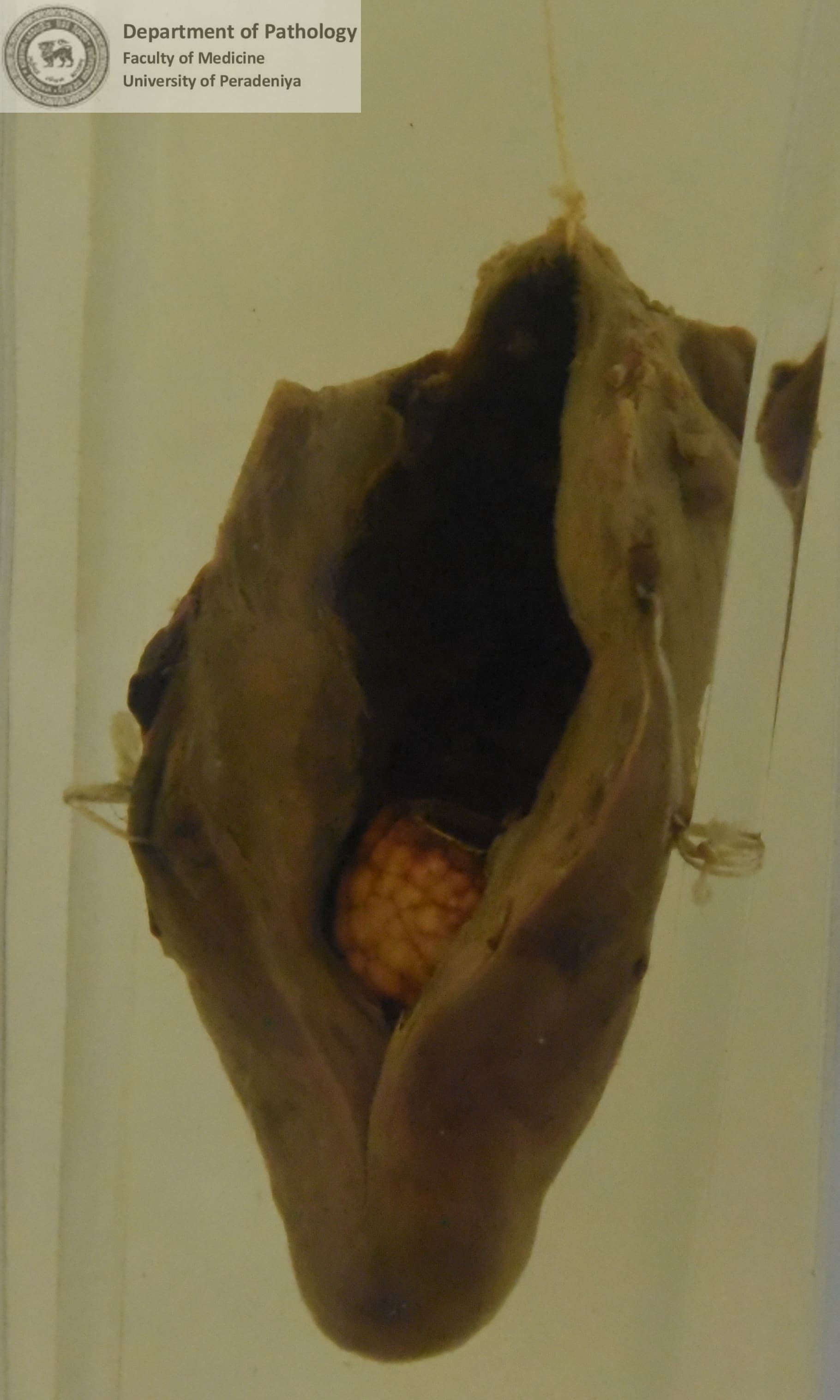 F a .26