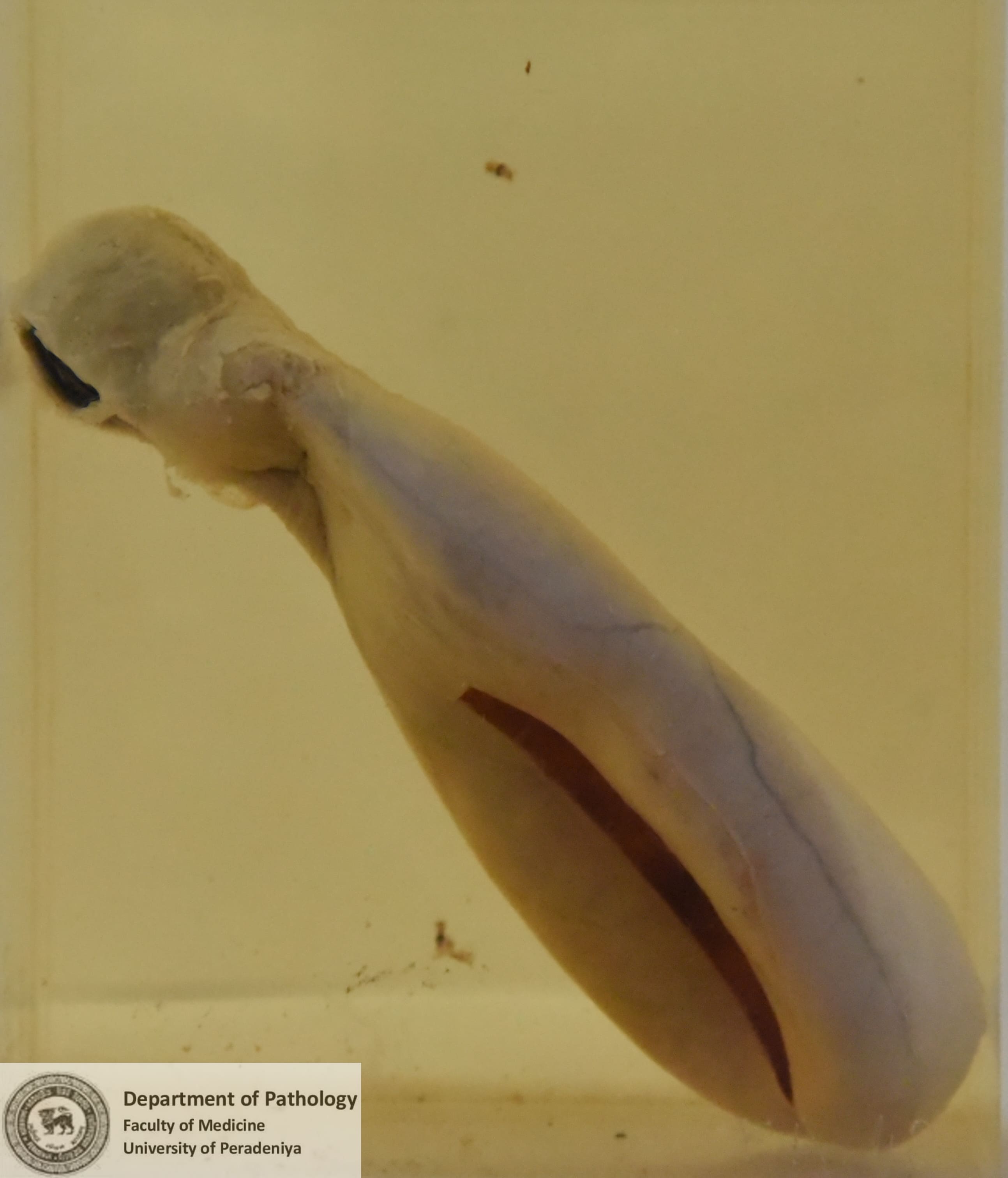 F a .42
