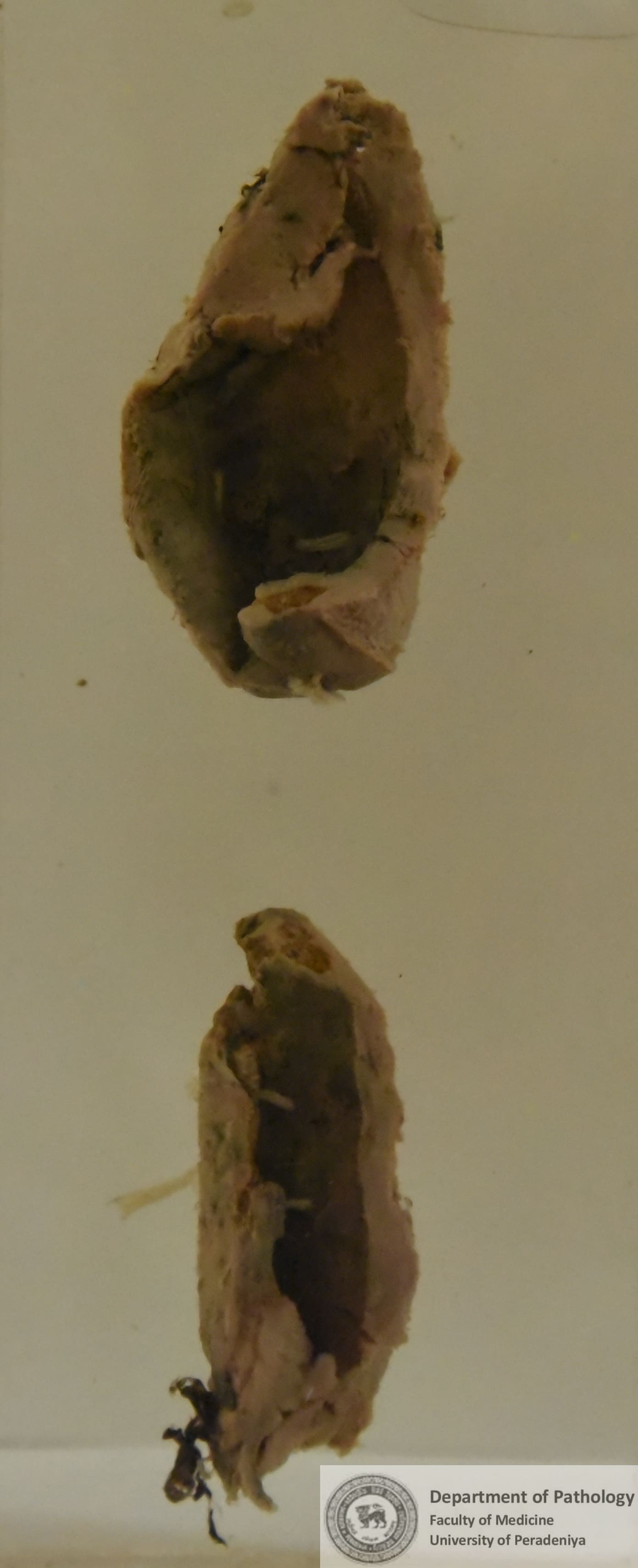 F a X.2