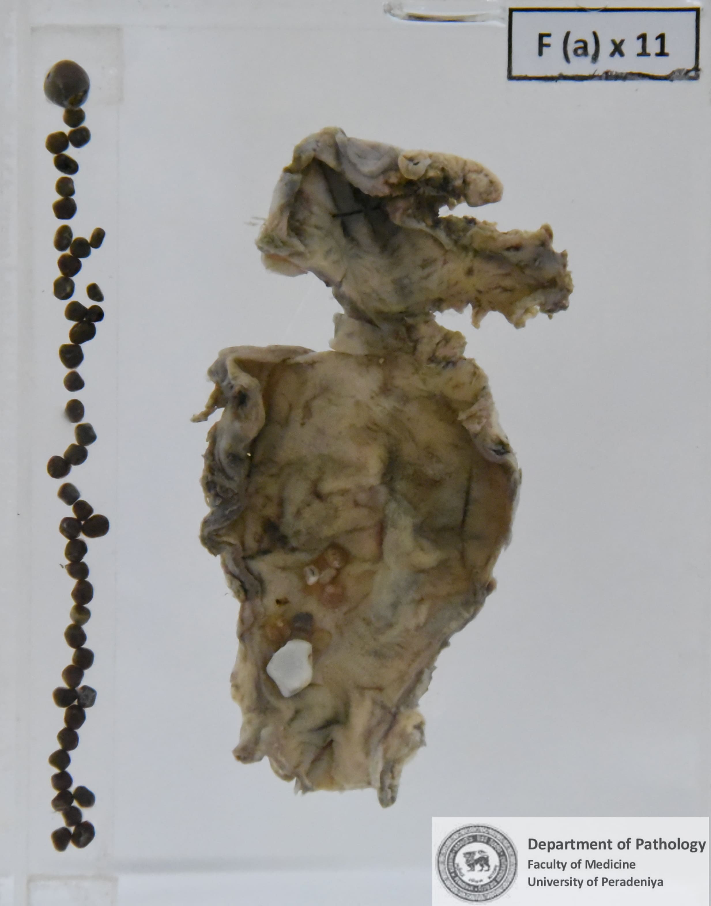F a X.11