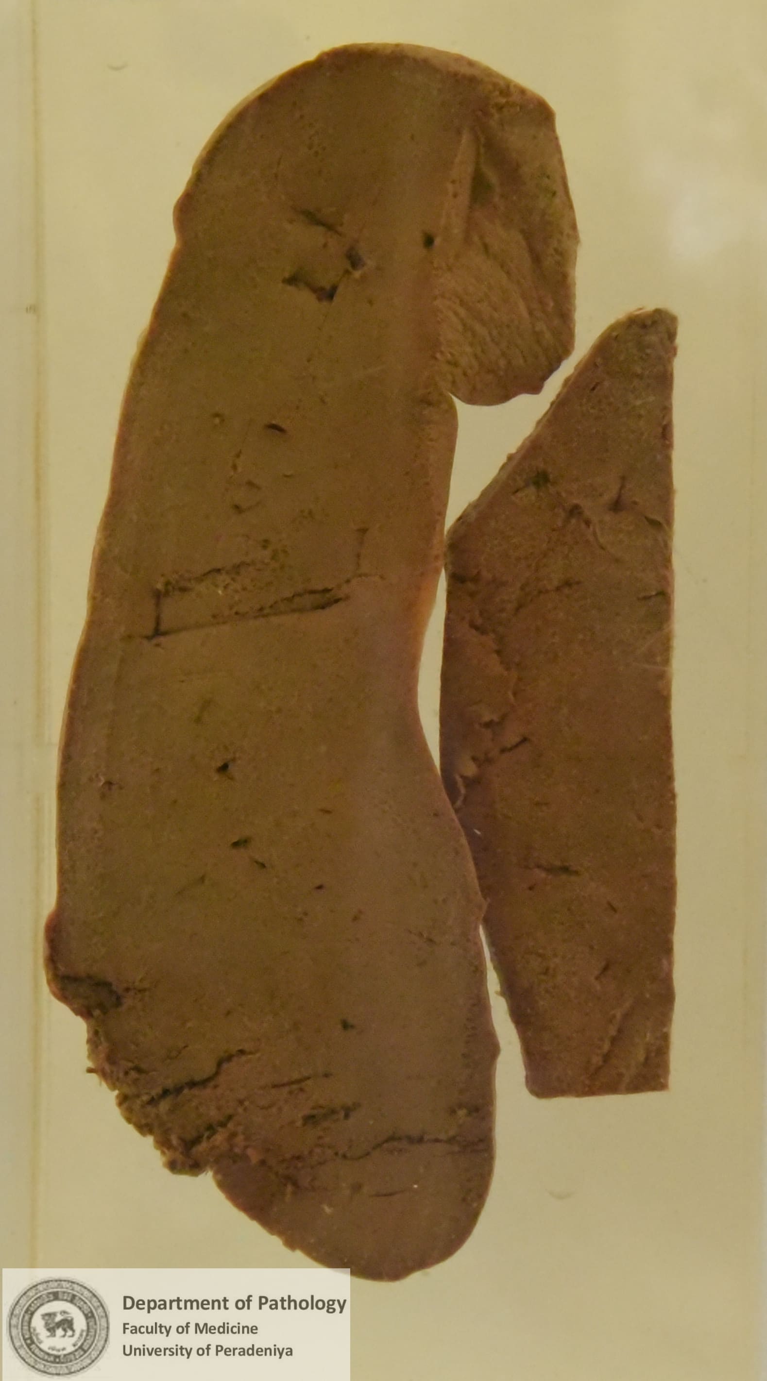 G.2