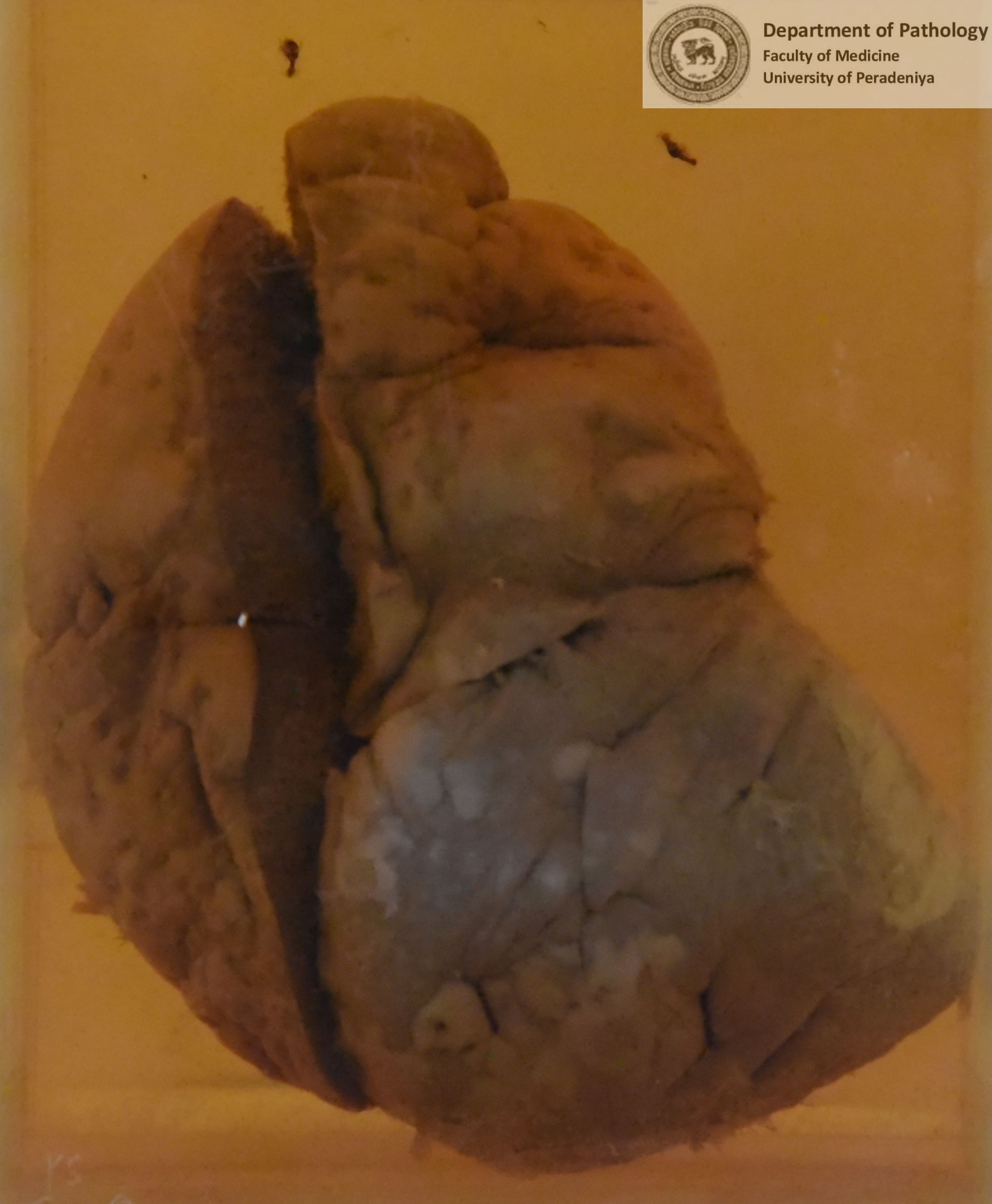 G.6