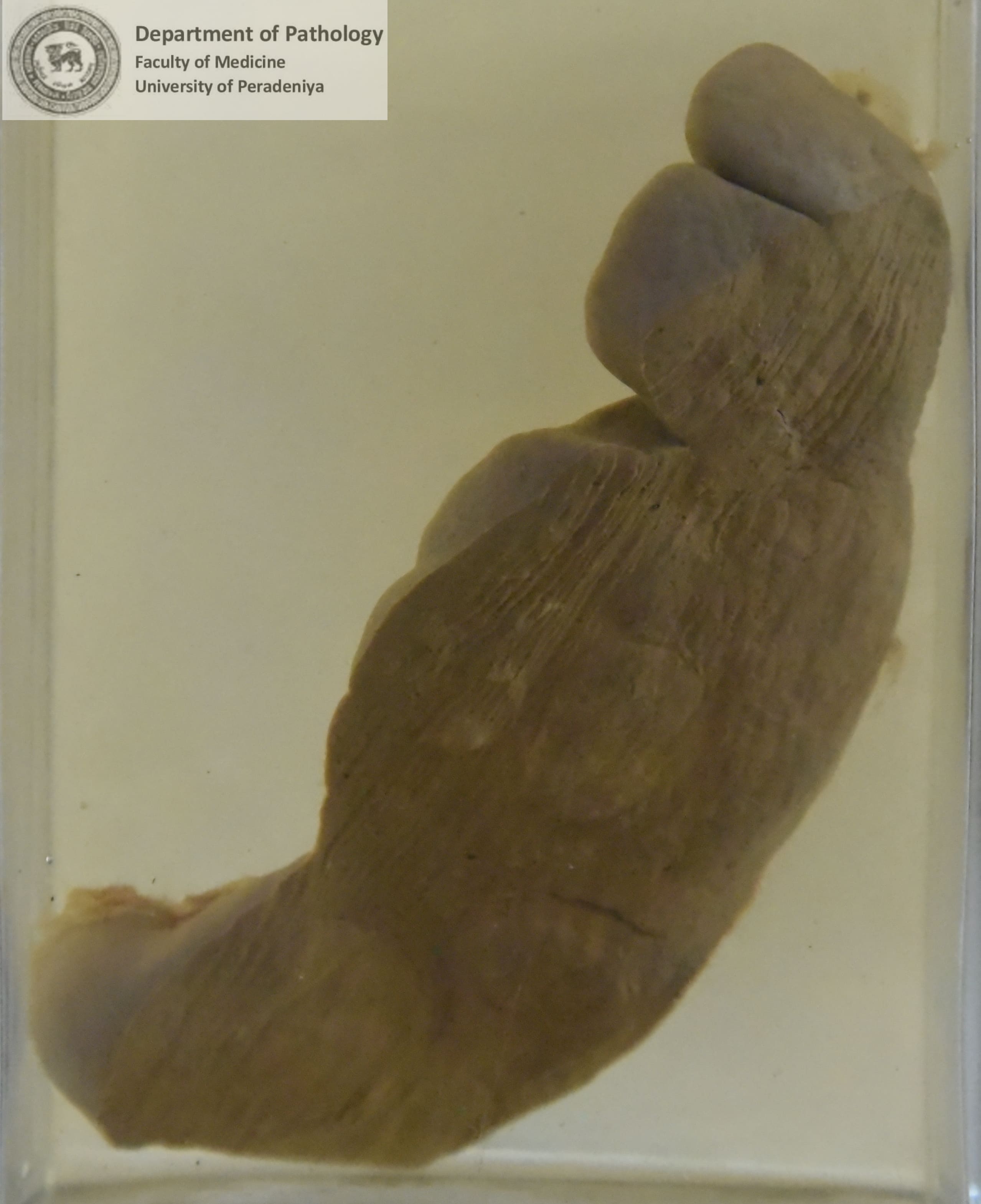 G.10