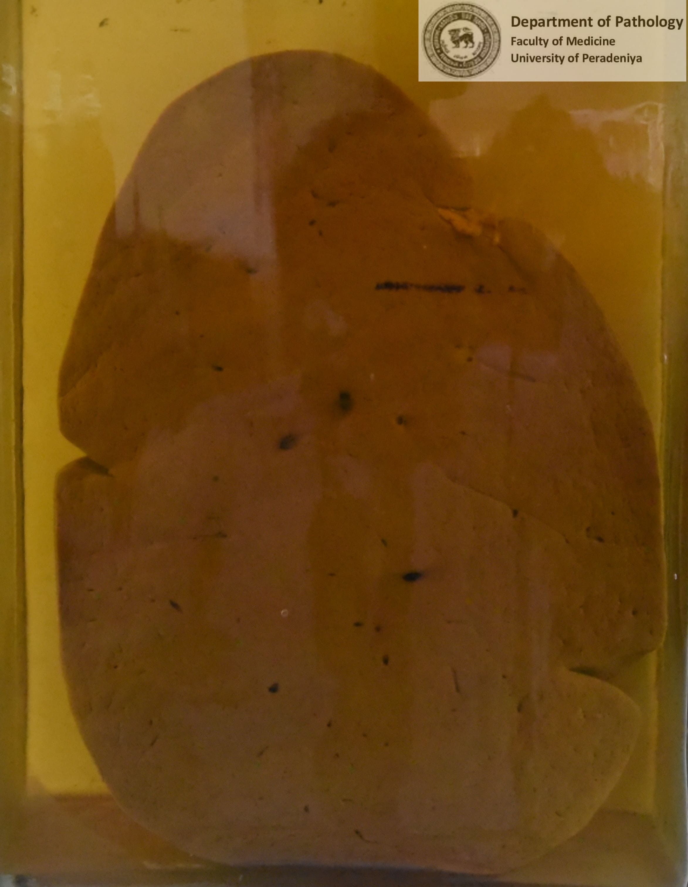 G.11