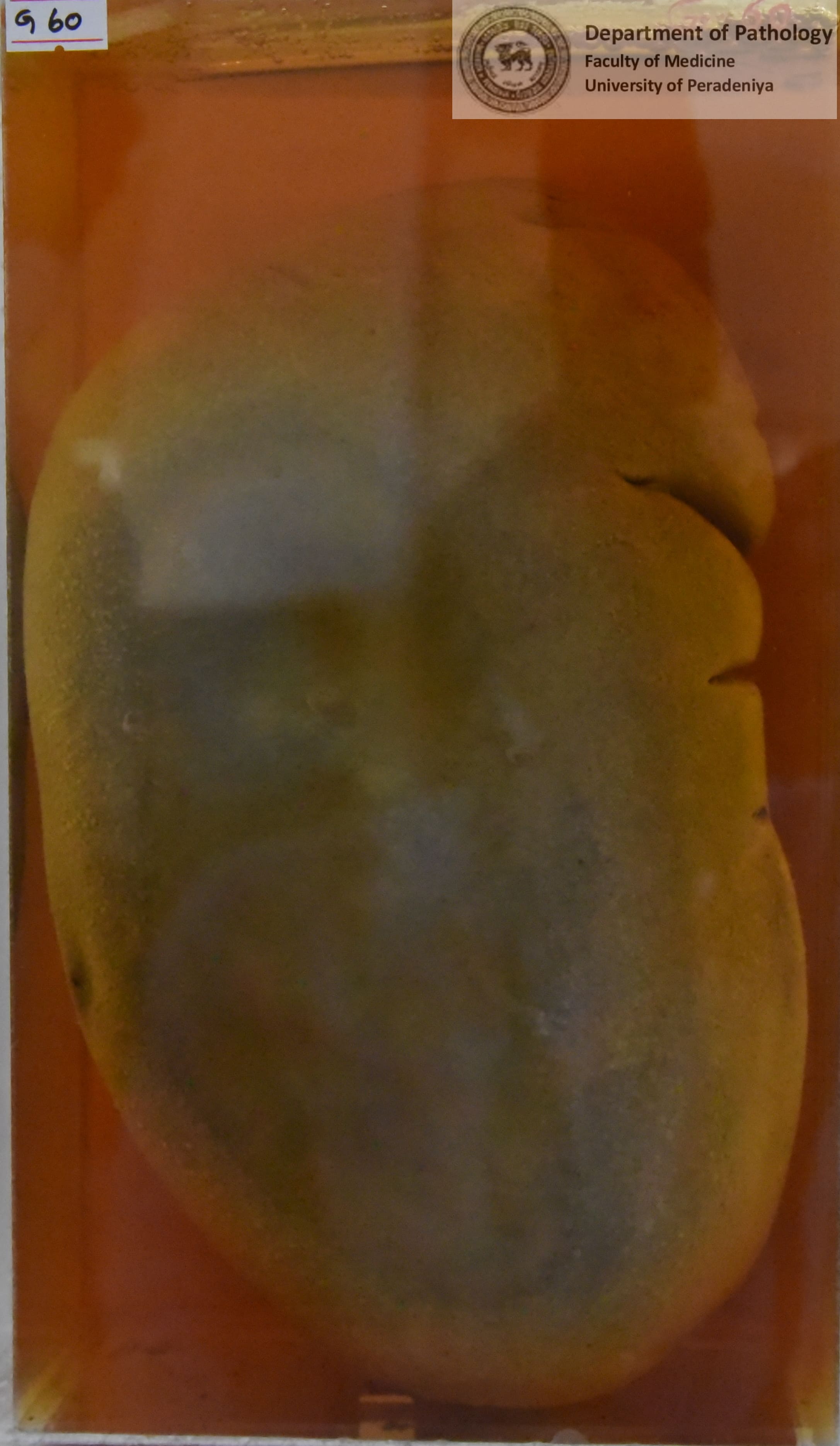 G.60