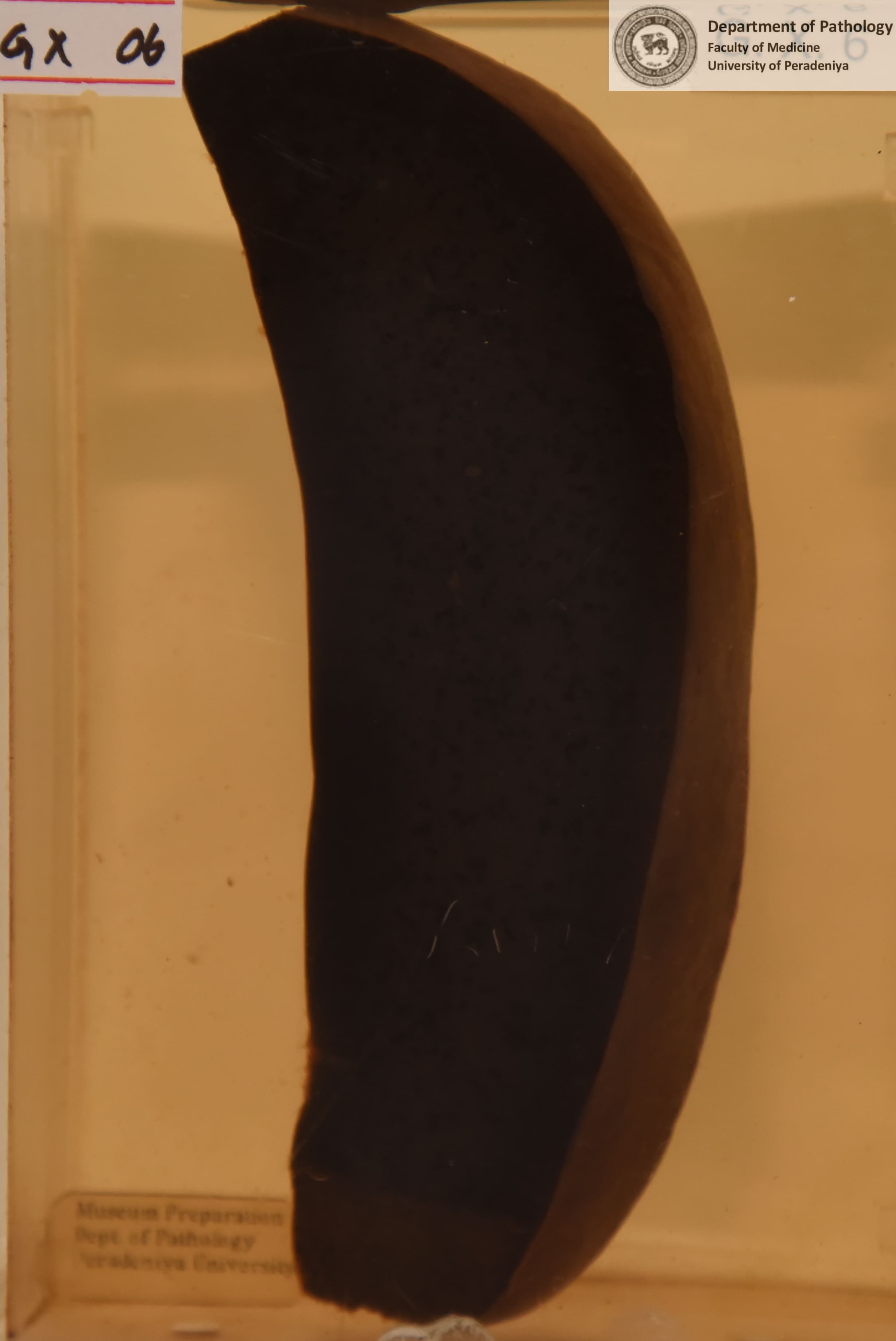 GX.6