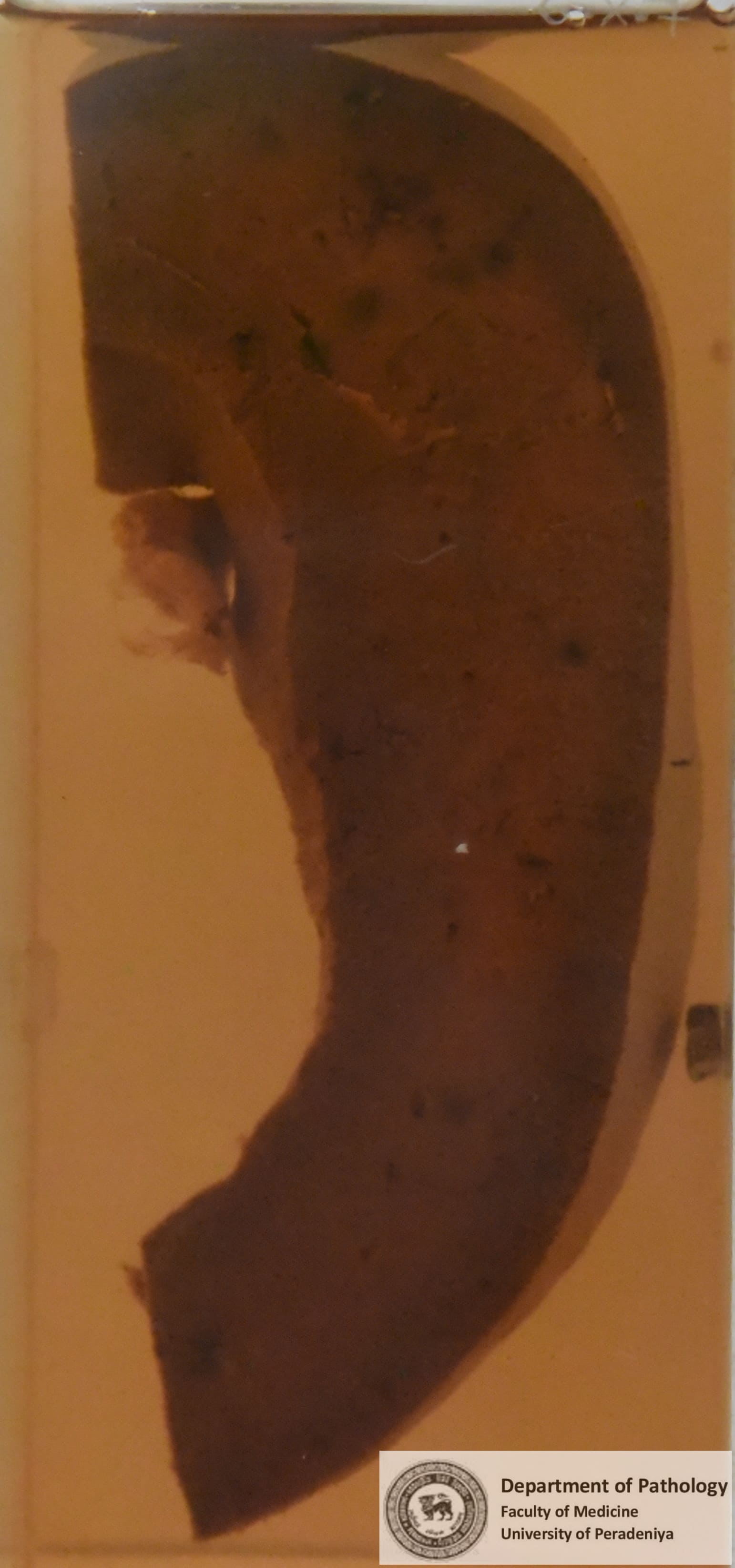 GX.7