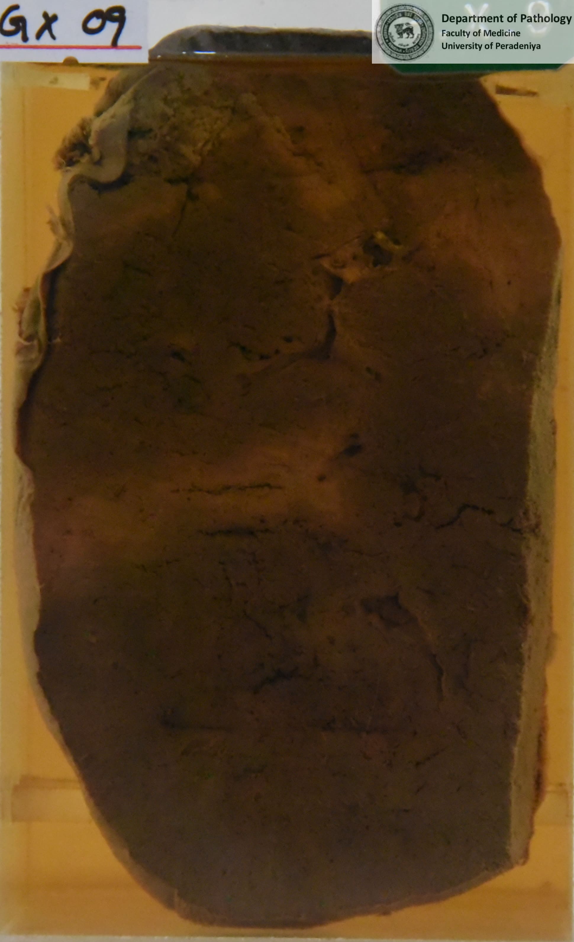 GX.9