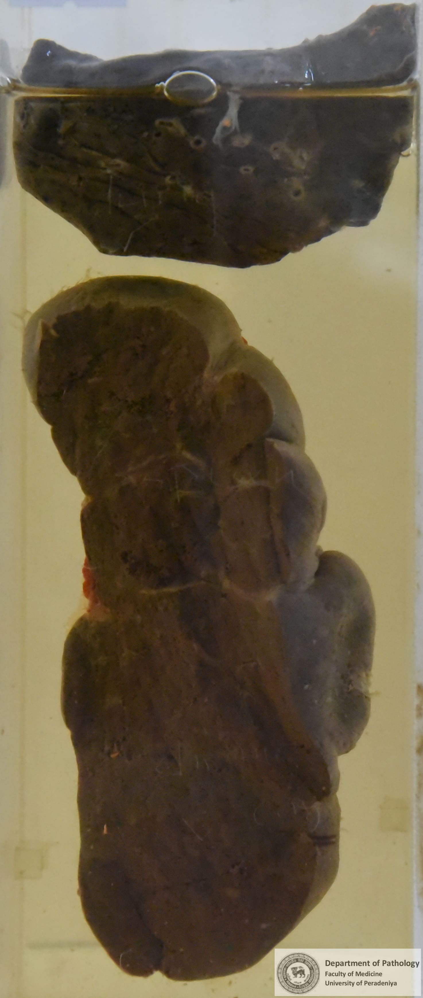 GX.15