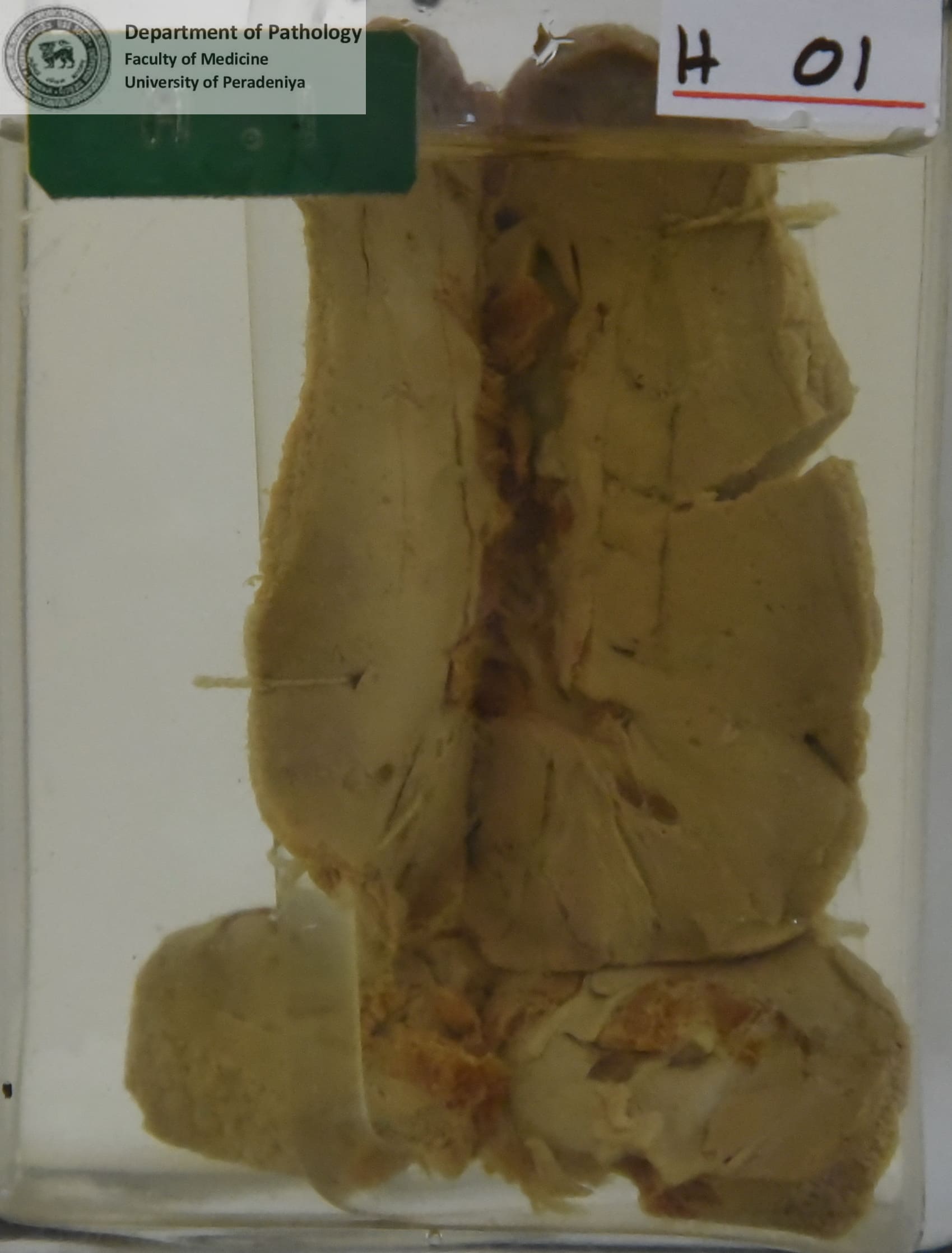 H.1