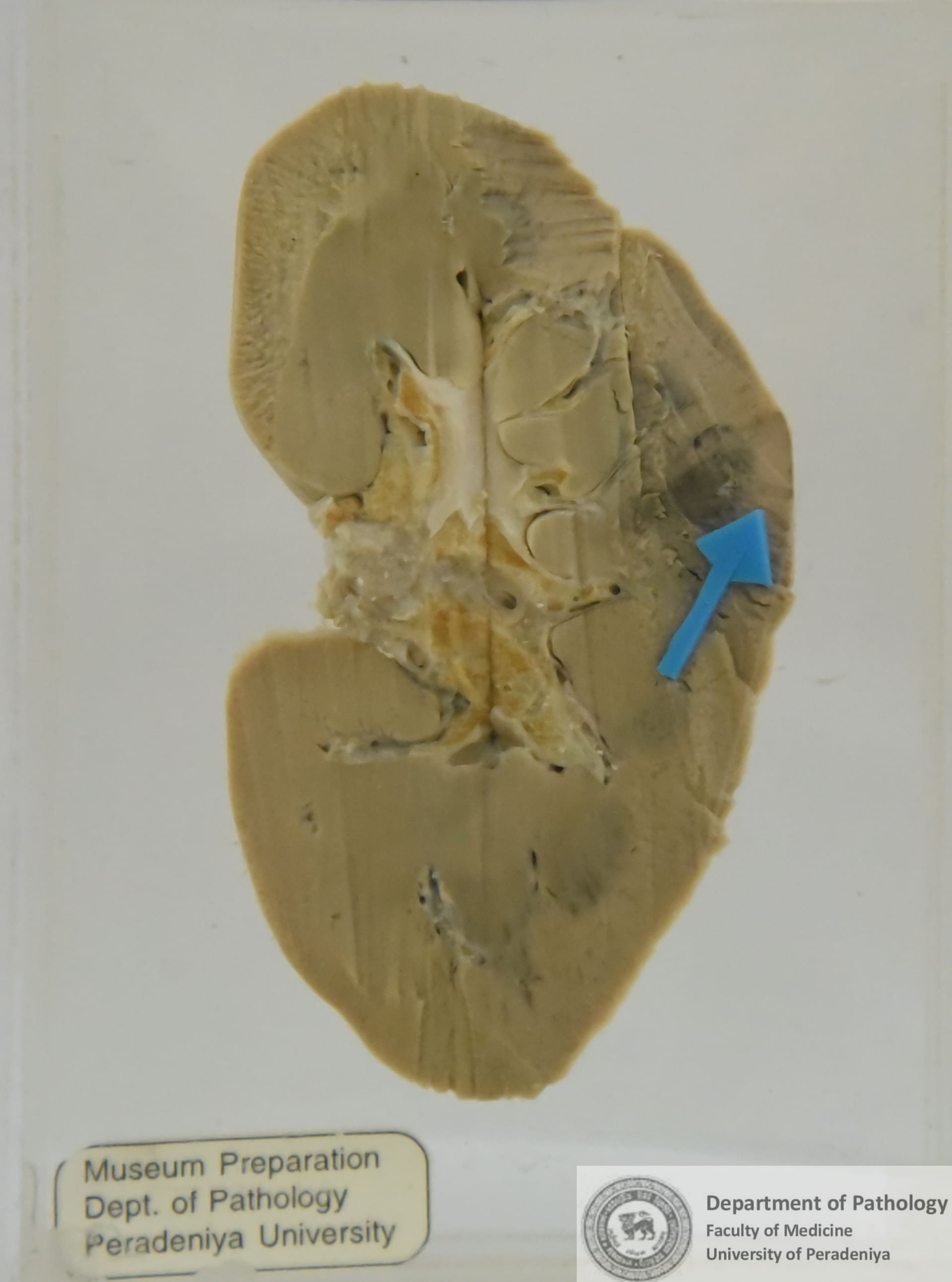 H.75