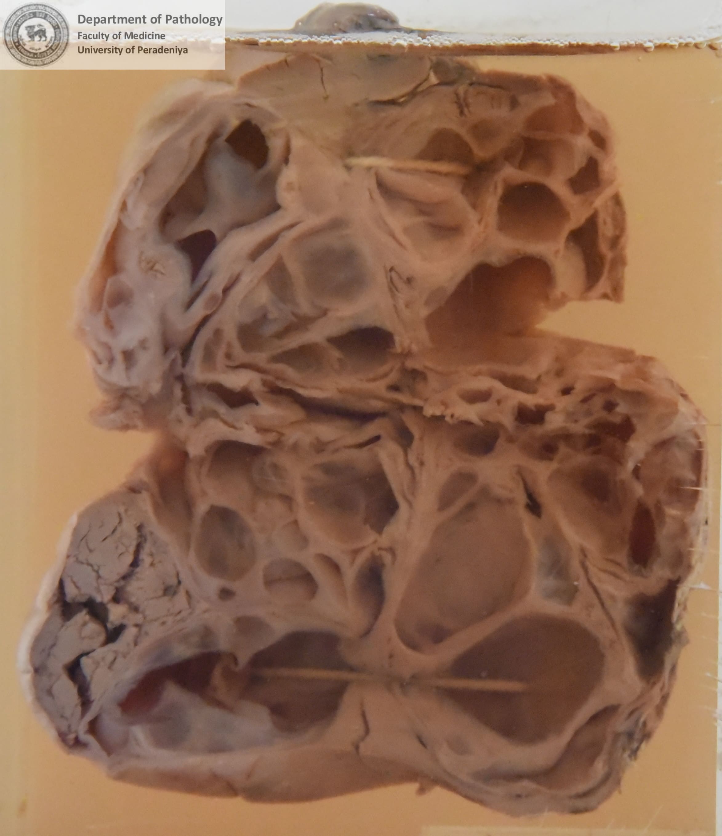 HX.3