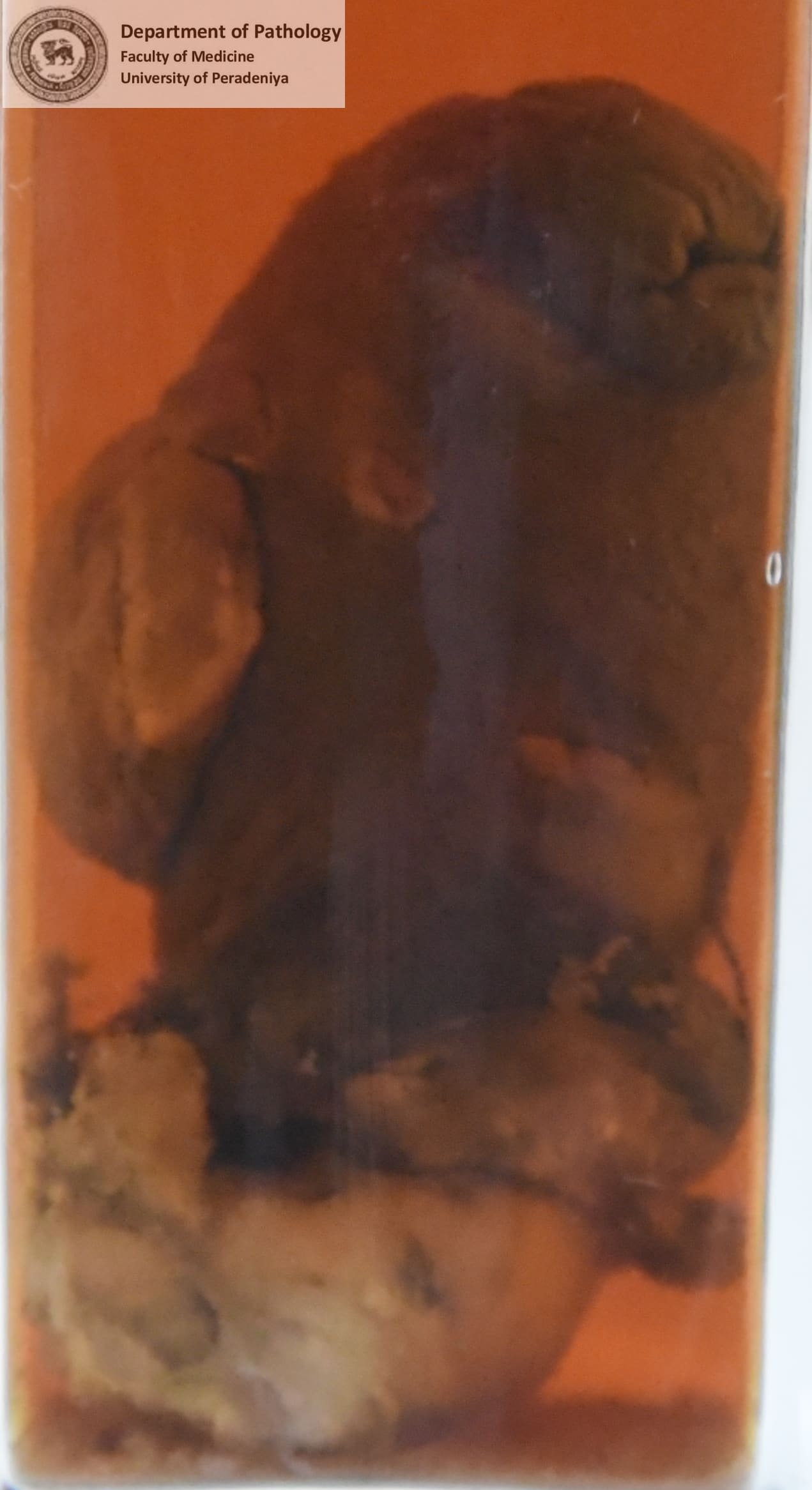 IX.4