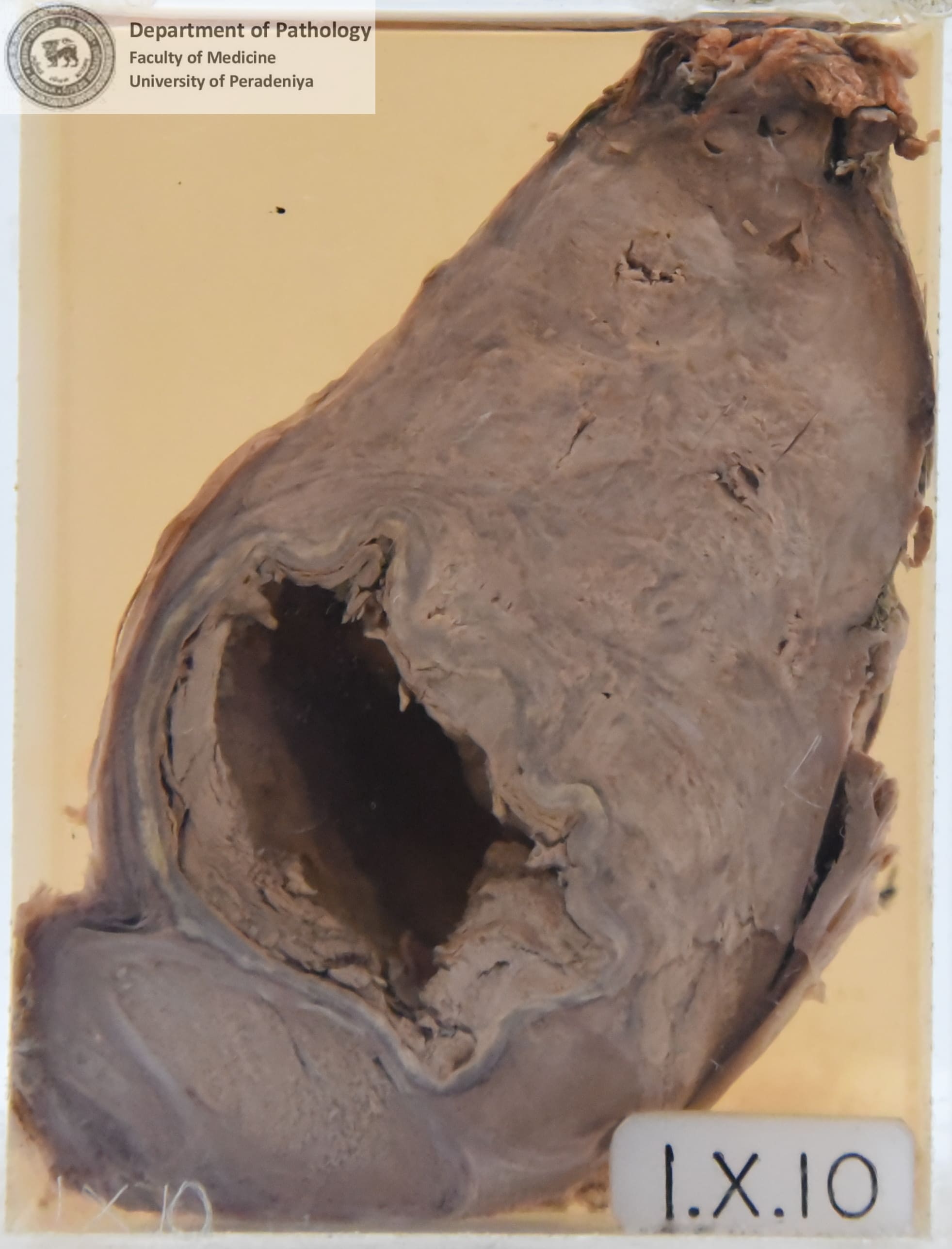 IX.10